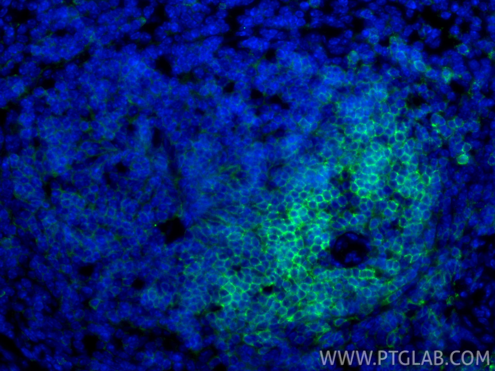 IF Staining of mouse spleen using 33173-1-AP Immunofluorescence (IF) / fluorescent staining of mouse spleen tissue using CD62L Polyclonal antibody (33173-1-AP)