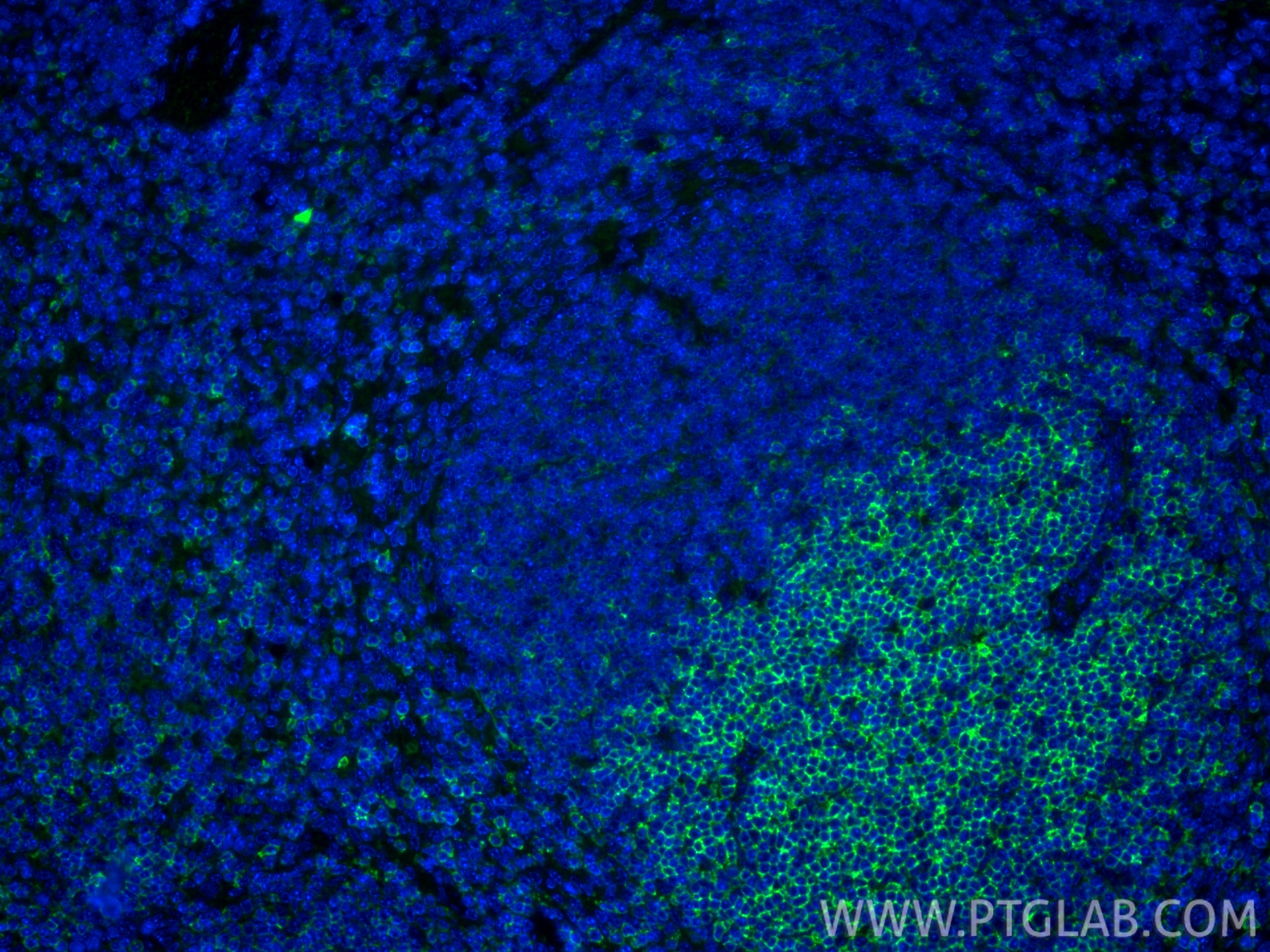 IF Staining of mouse spleen using 33173-1-AP Immunofluorescence (IF) / fluorescent staining of mouse spleen tissue using CD62L Polyclonal antibody (33173-1-AP)