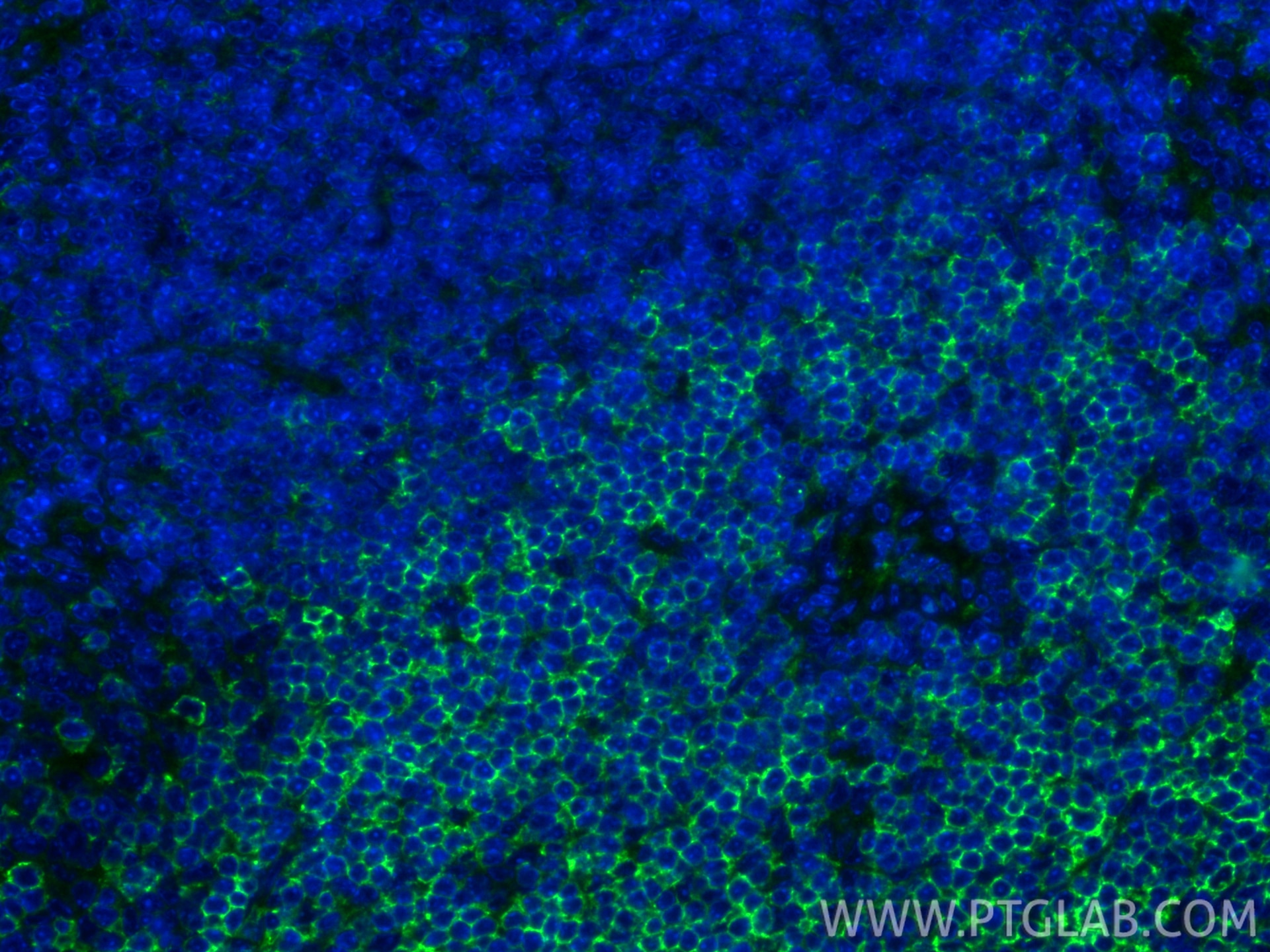 IF Staining of mouse spleen using 33173-1-AP Immunofluorescence (IF) / fluorescent staining of mouse spleen tissue using CD62L Polyclonal antibody (33173-1-AP)