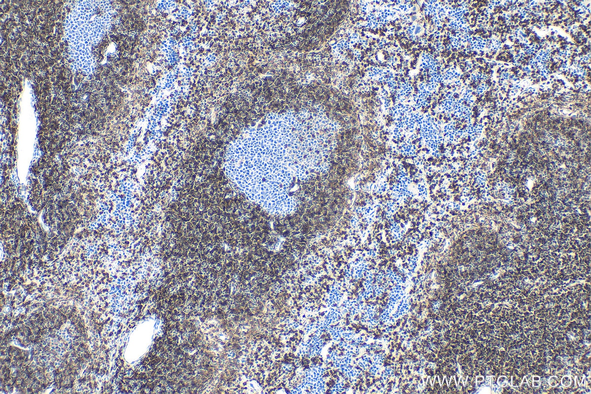 IHC staining of mouse spleen using 33173-1-AP Immunohistochemistry (IHC) staining of mouse spleen tissue using CD62L Polyclonal antibody (33173-1-AP)
