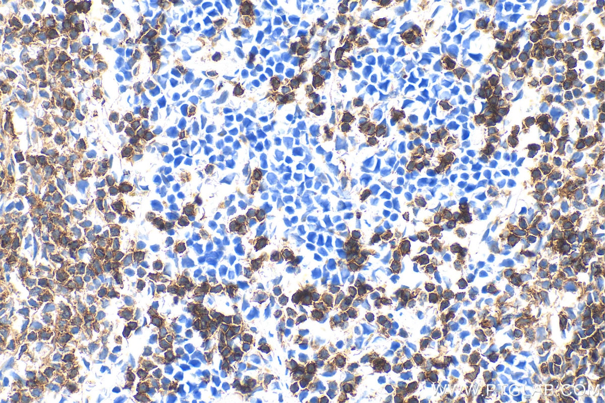 IHC staining of mouse spleen using 33173-1-AP Immunohistochemistry (IHC) staining of mouse spleen tissue using CD62L Polyclonal antibody (33173-1-AP)