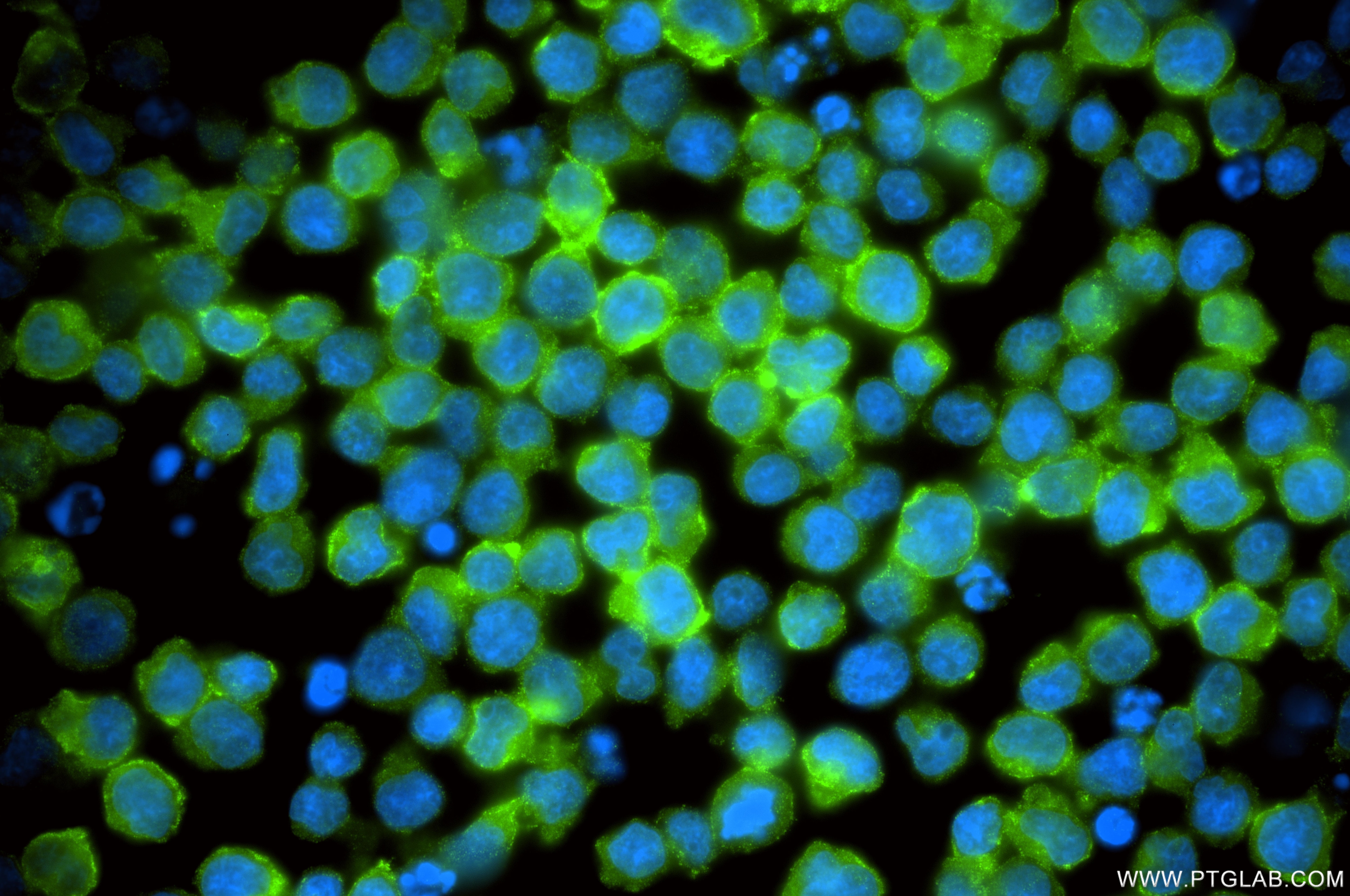 Immunofluorescence (IF) / fluorescent staining of Jurkat cells using CD62L Recombinant monoclonal antibody (85111-6-RR)