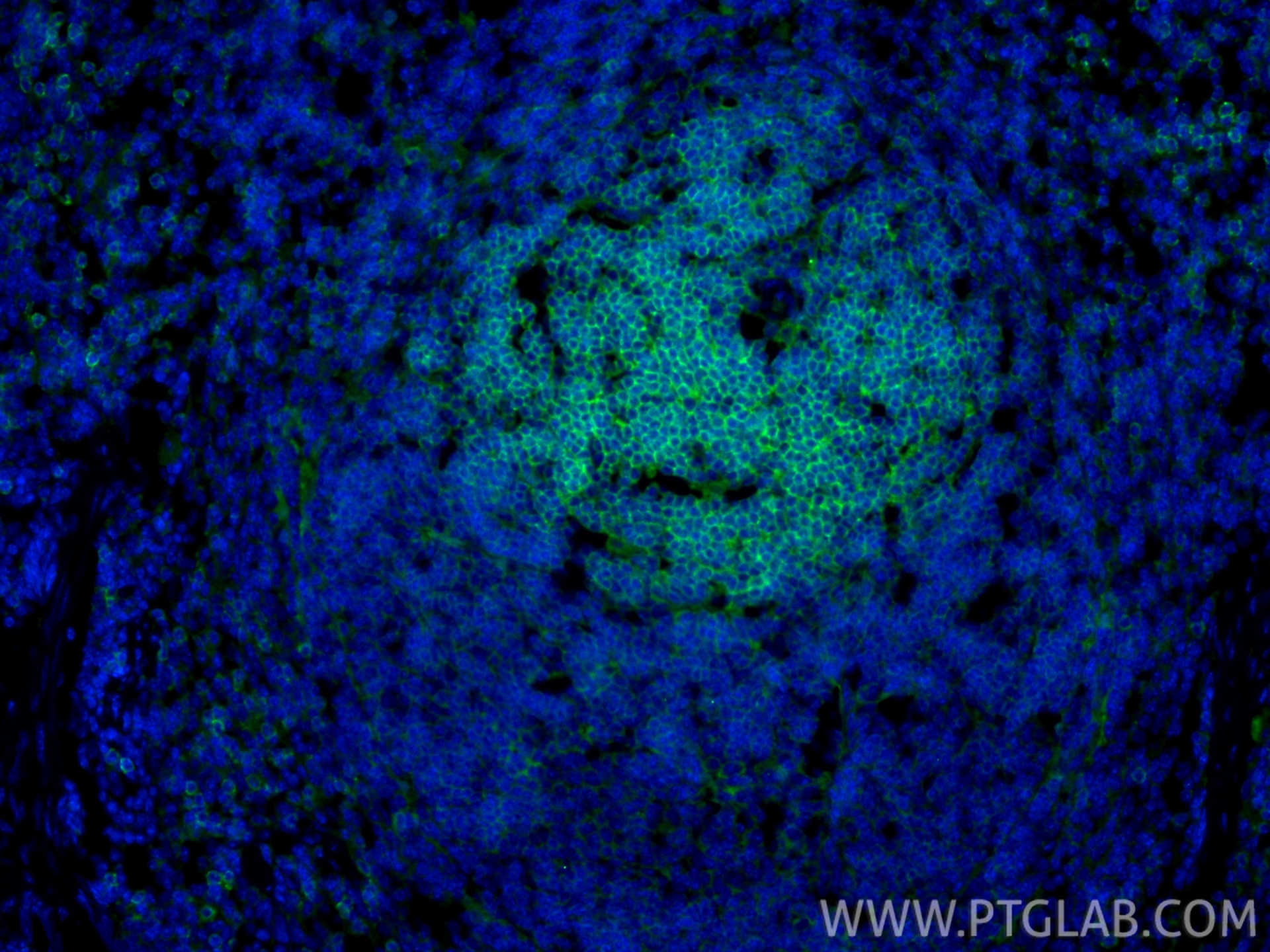 Immunofluorescence (IF) / fluorescent staining of mouse spleen tissue using CD62L Recombinant monoclonal antibody (85903-1-RR)