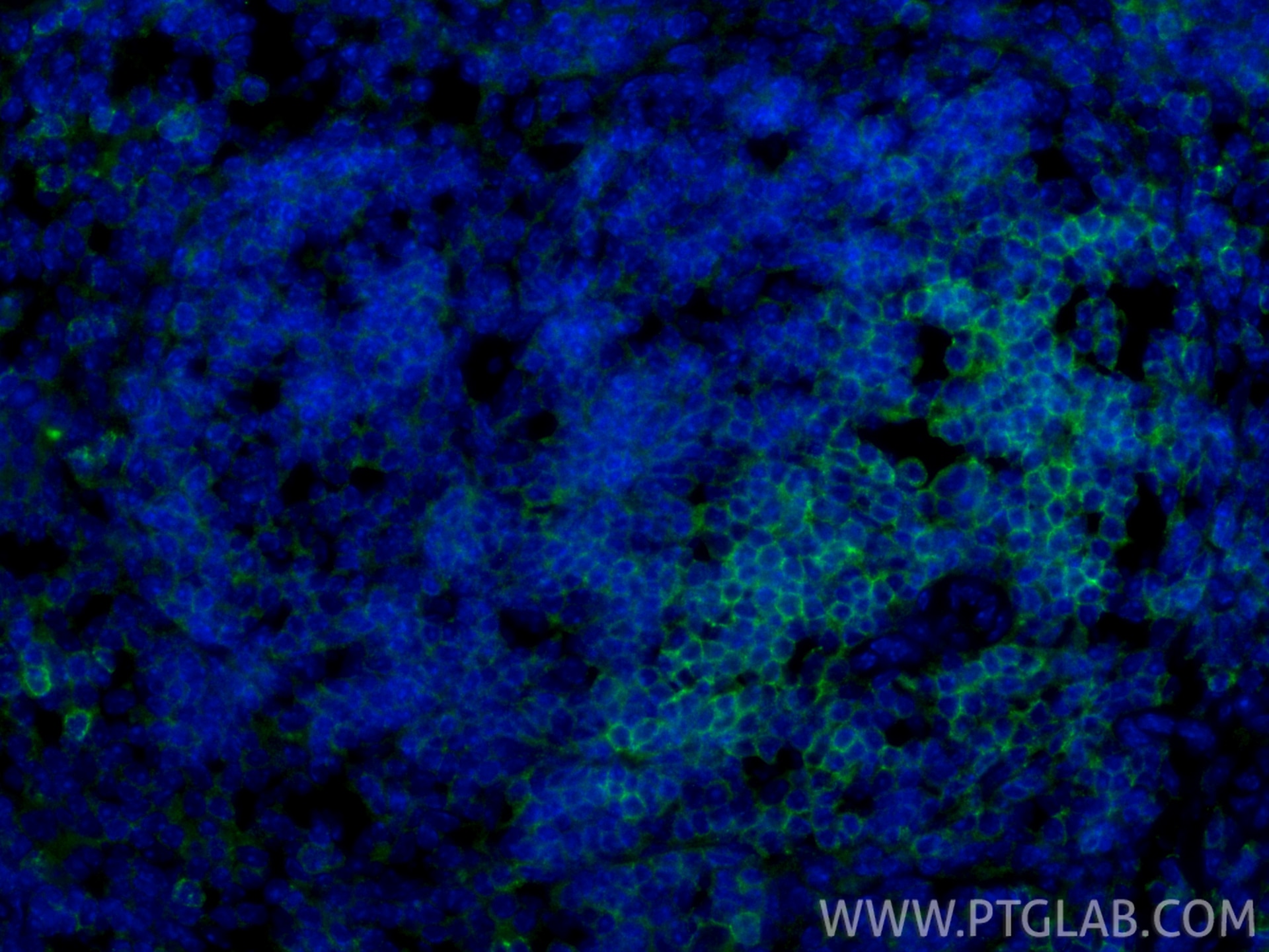 Immunofluorescence (IF) / fluorescent staining of mouse spleen tissue using CD62L Recombinant monoclonal antibody (85903-1-RR)