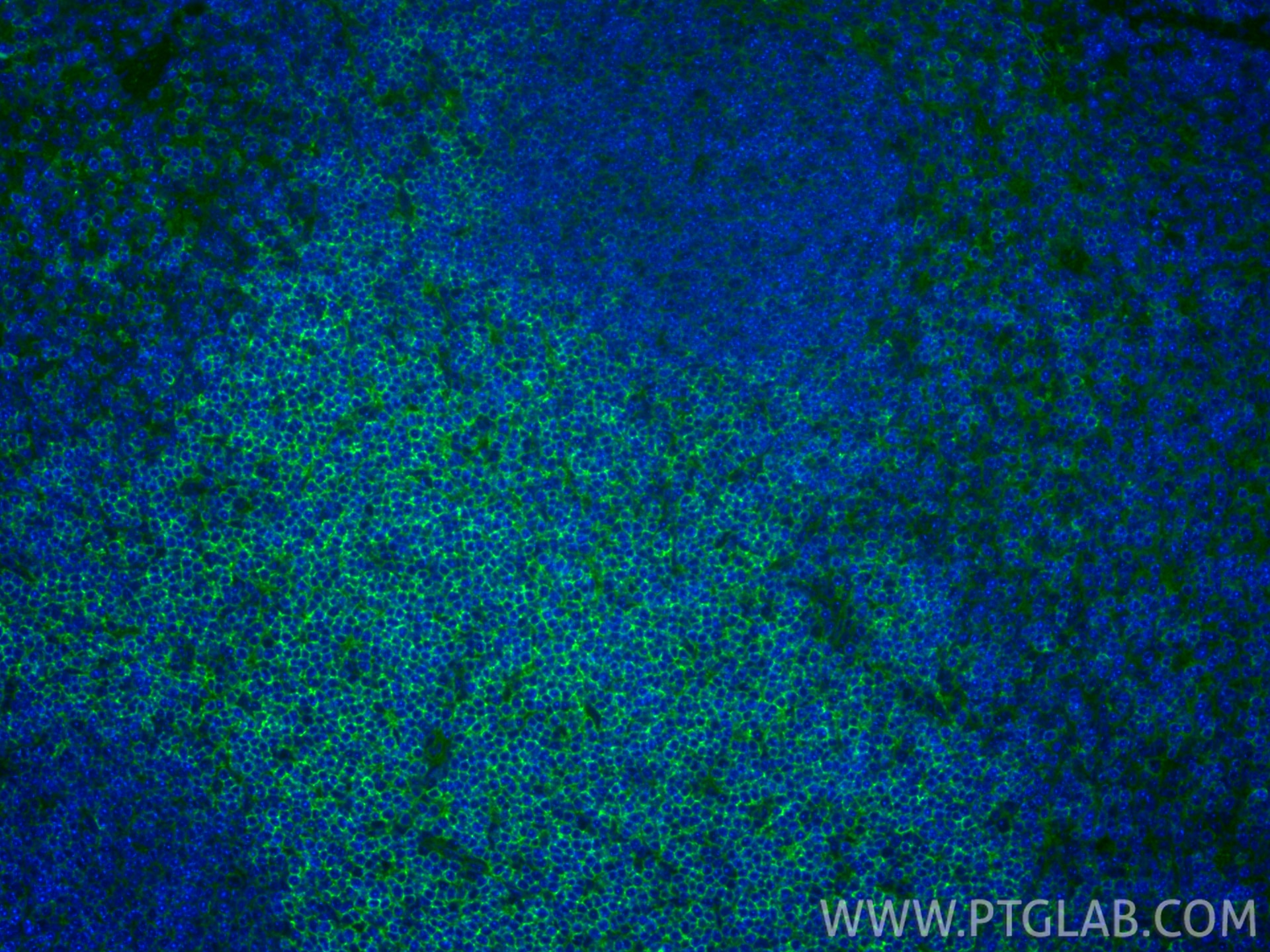 Immunofluorescence (IF) / fluorescent staining of mouse spleen tissue using CD62L Recombinant monoclonal antibody (85903-1-RR)