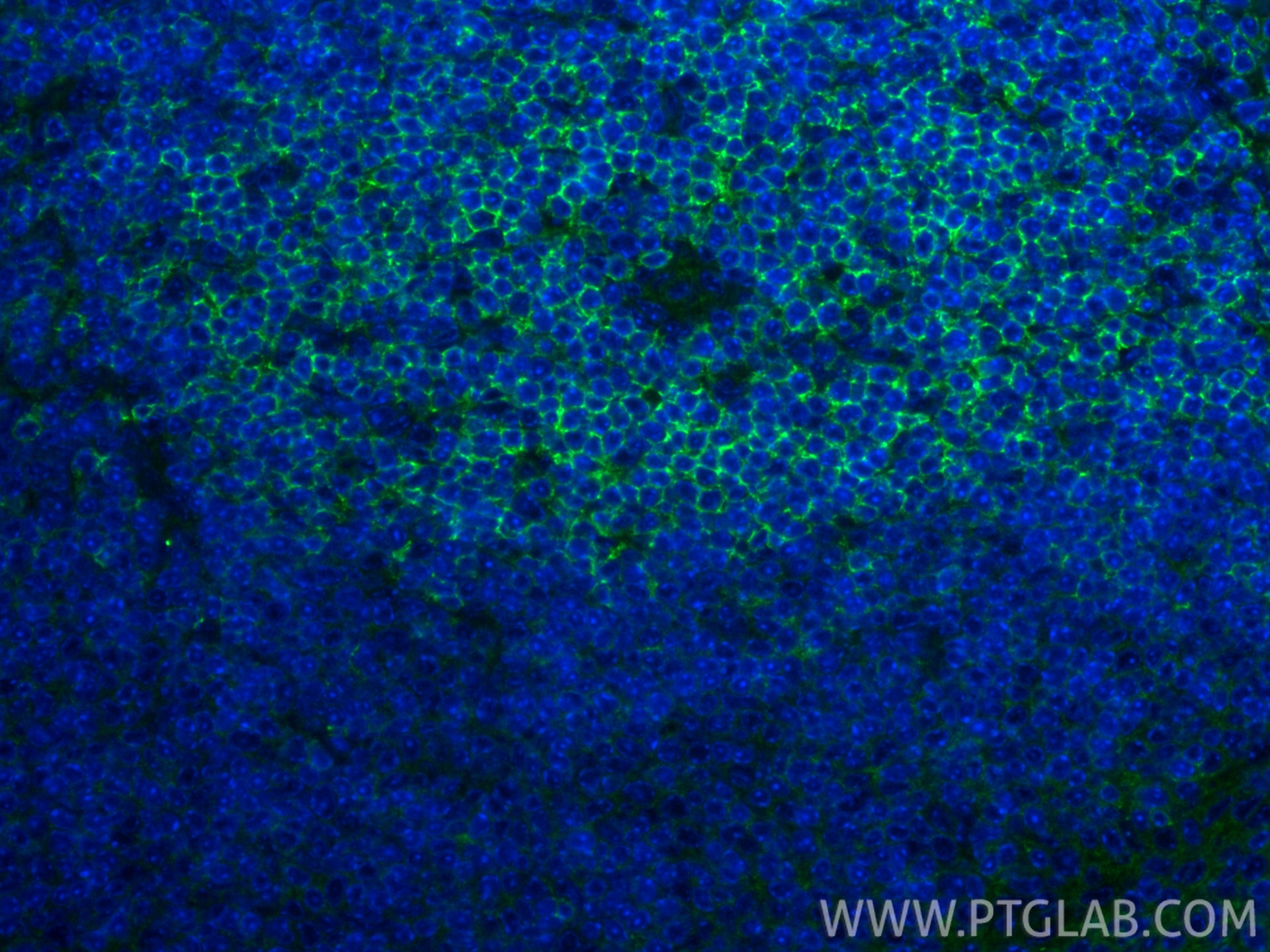 Immunofluorescence (IF) / fluorescent staining of mouse spleen tissue using CD62L Recombinant monoclonal antibody (85903-1-RR)