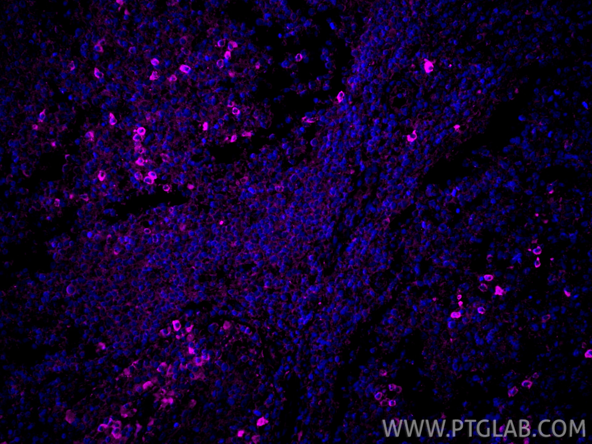 Immunofluorescence (IF) / fluorescent staining of human tonsillitis tissue using CoraLite® Plus 647-conjugated CD62L Polyclonal ant (CL647-26477)