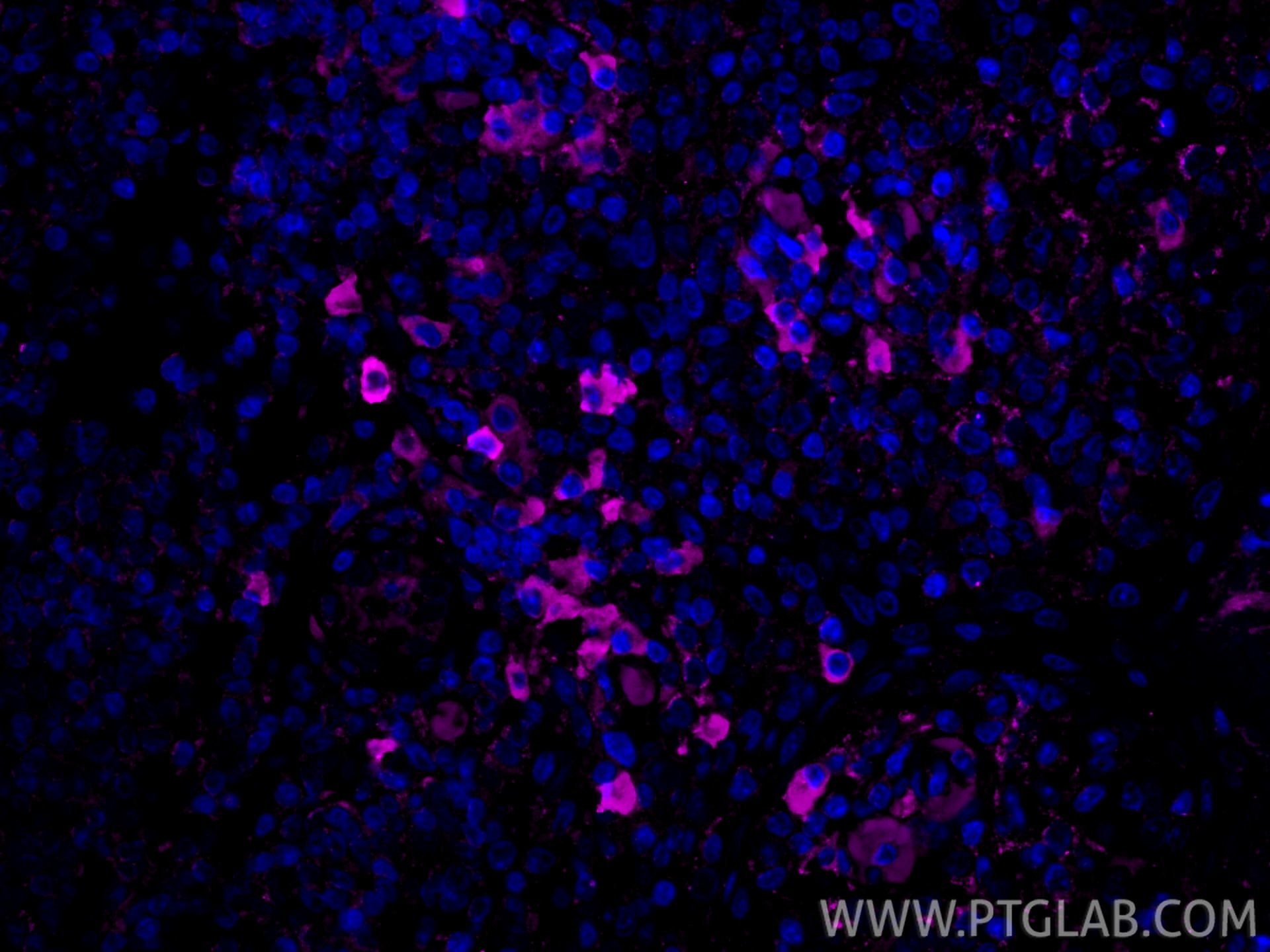 Immunofluorescence (IF) / fluorescent staining of human tonsillitis tissue using CoraLite® Plus 647-conjugated CD62L Polyclonal ant (CL647-26477)