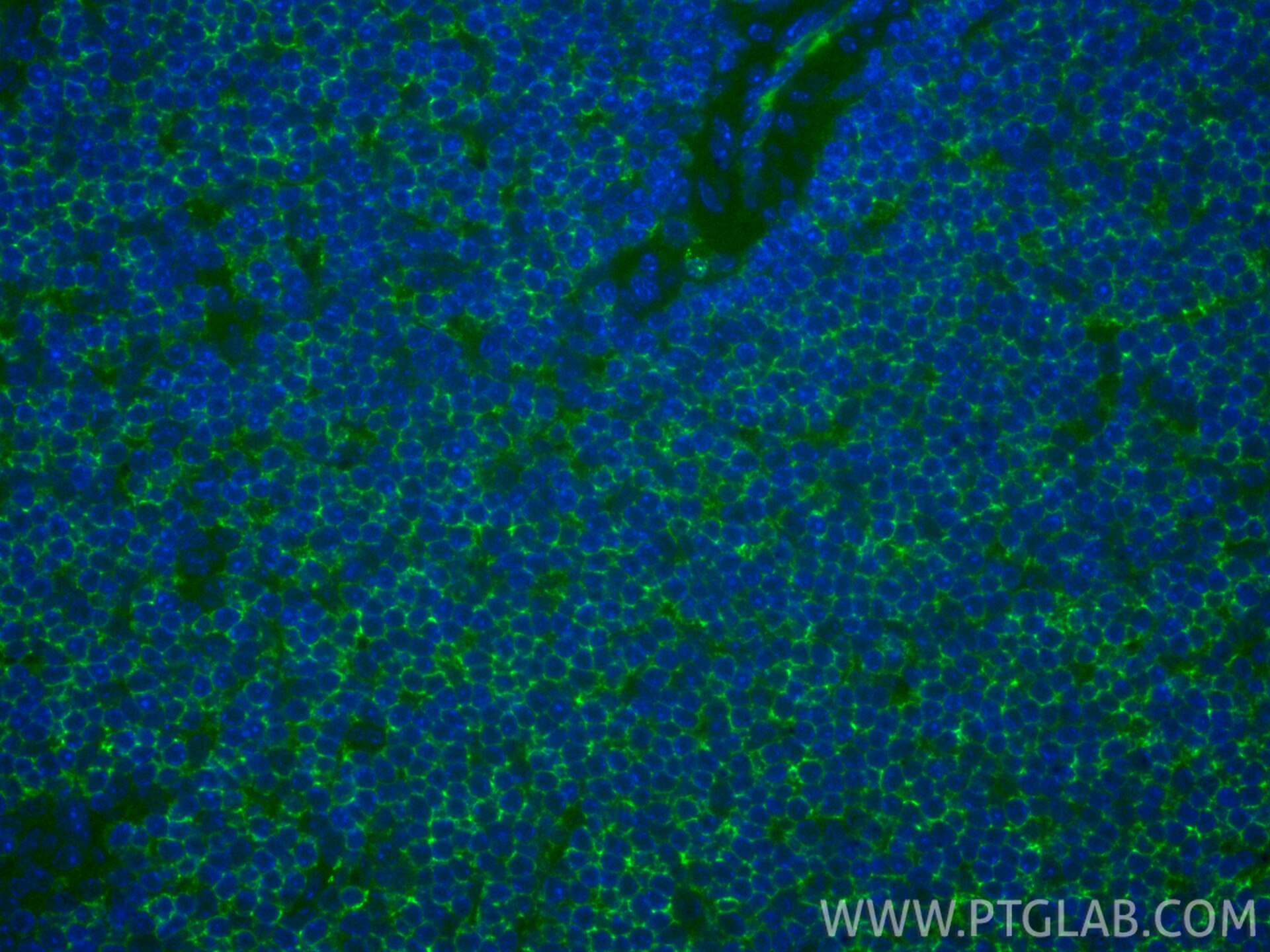 IF Staining of mouse spleen using FITC-33173 Immunofluorescence (IF) / fluorescent staining of mouse spleen tissue using FITC Plus-conjugated CD62L Polyclonal antibody (FITC-33173)