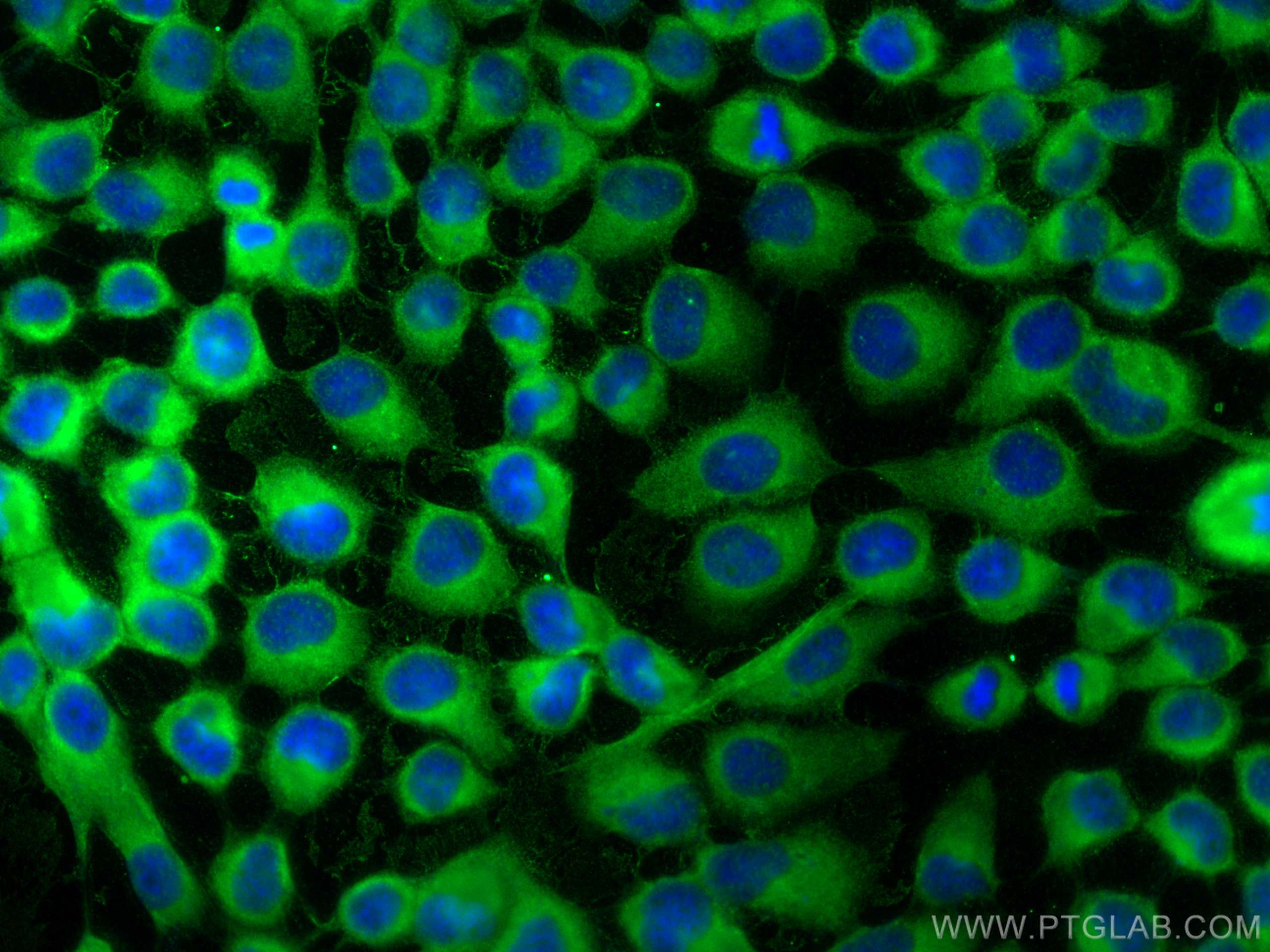 Immunofluorescence (IF) / fluorescent staining of A431 cells using CD63 Polyclonal antibody (25682-1-AP)
