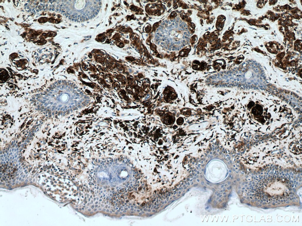 CD63 Antibody 25682-1-AP | Proteintech