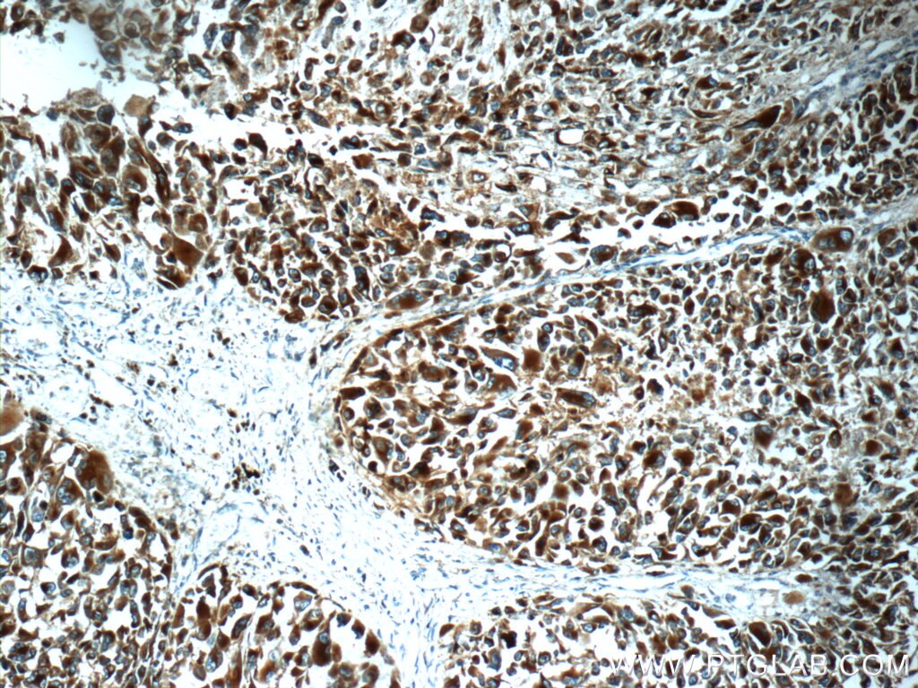 CD63 Polyclonal antibody