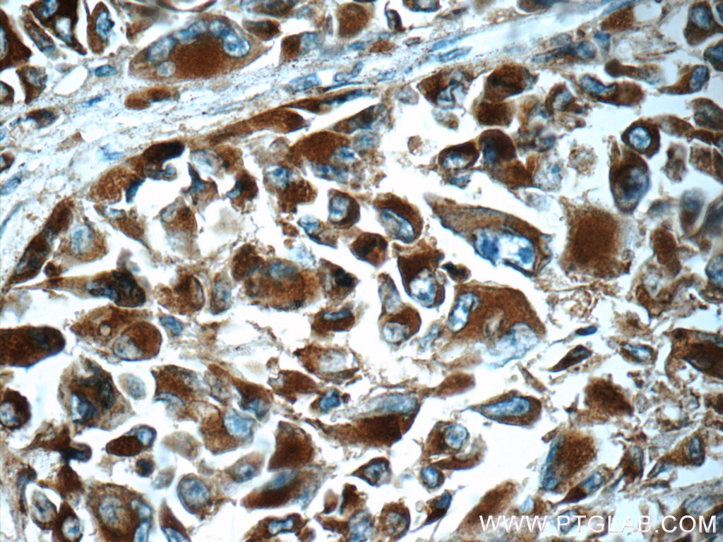 CD63 Polyclonal antibody