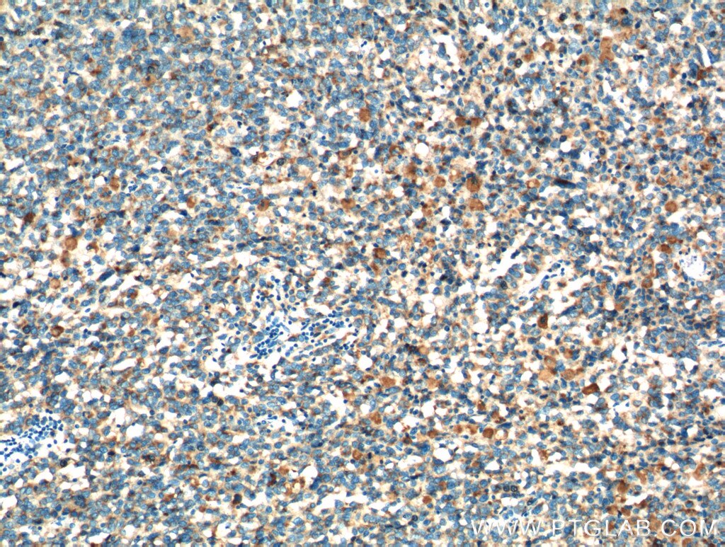 CD63 Polyclonal antibody