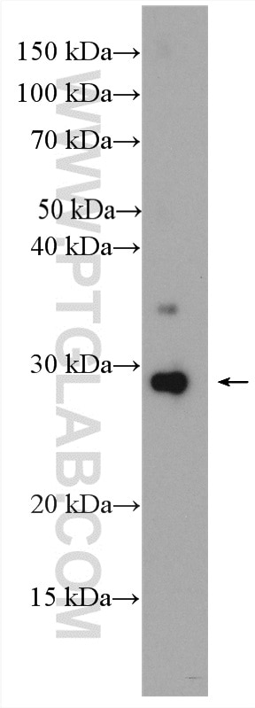 Western Blot (WB) analysis of human serum exosomes using CD63 Polyclonal antibody (25682-1-AP)