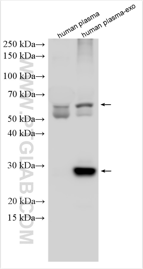 Western Blot (WB) analysis of various lysates using CD63 Polyclonal antibody (25682-1-AP)