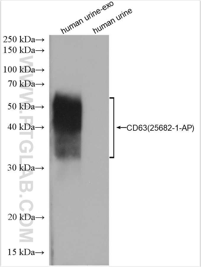 Western Blot (WB) analysis of human urine exosomes tissue using CD63 Polyclonal antibody (25682-1-AP)