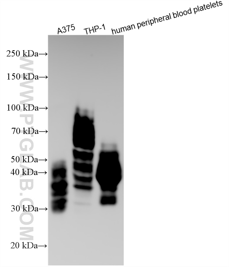 Western Blot (WB) analysis of various lysates using CD63 Polyclonal antibody (25682-1-AP)
