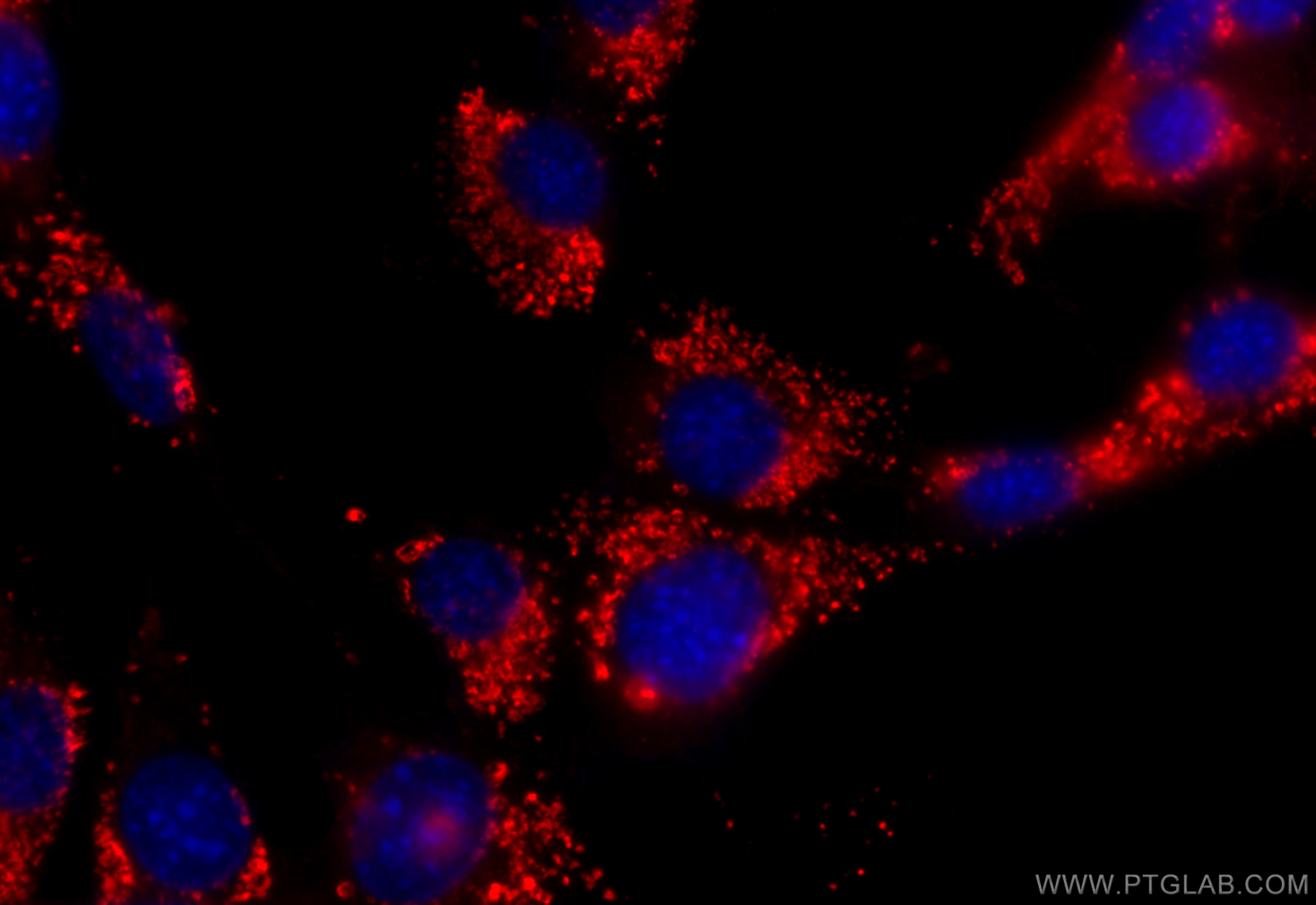 Immunofluorescence (IF) / fluorescent staining of NIH/3T3 cells using CD63 Polyclonal antibody (32151-1-AP)