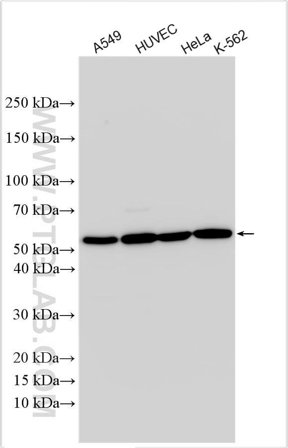 Western Blot (WB) analysis of various lysates using CD63 Polyclonal antibody (32151-1-AP)