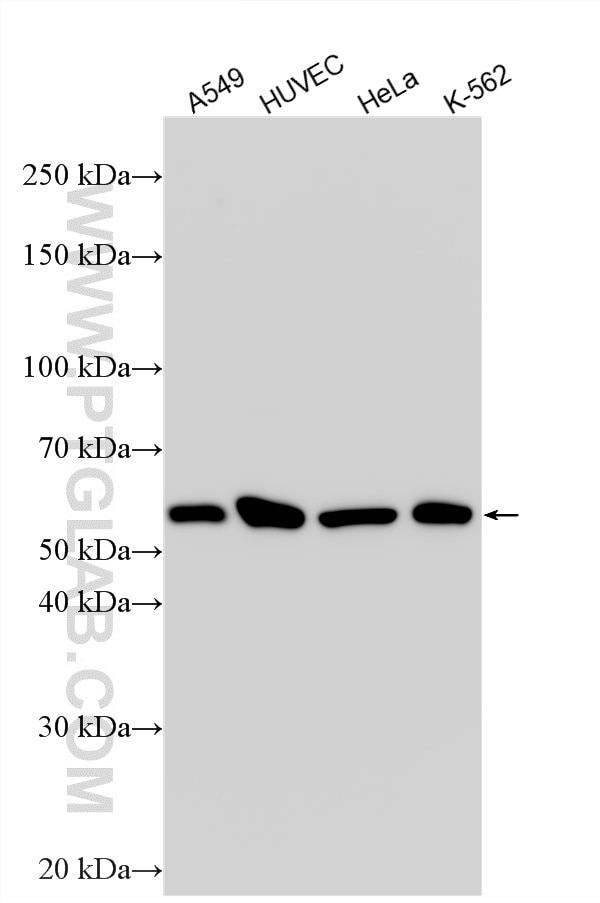 Western Blot (WB) analysis of various lysates using CD63 Polyclonal antibody (32151-1-AP)