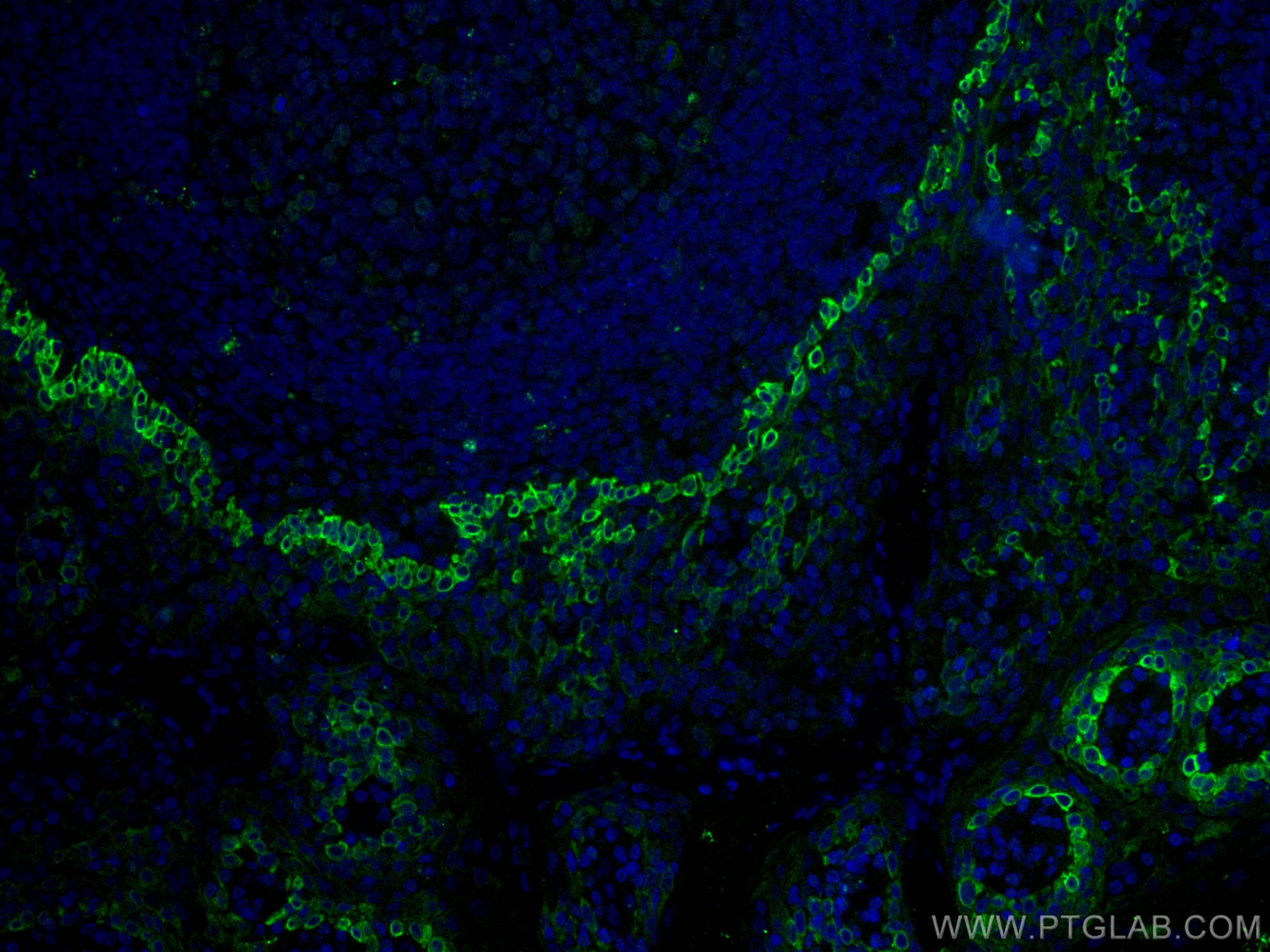 Immunofluorescence (IF) / fluorescent staining of human tonsillitis tissue using CD63 Monoclonal antibody (67605-1-Ig)