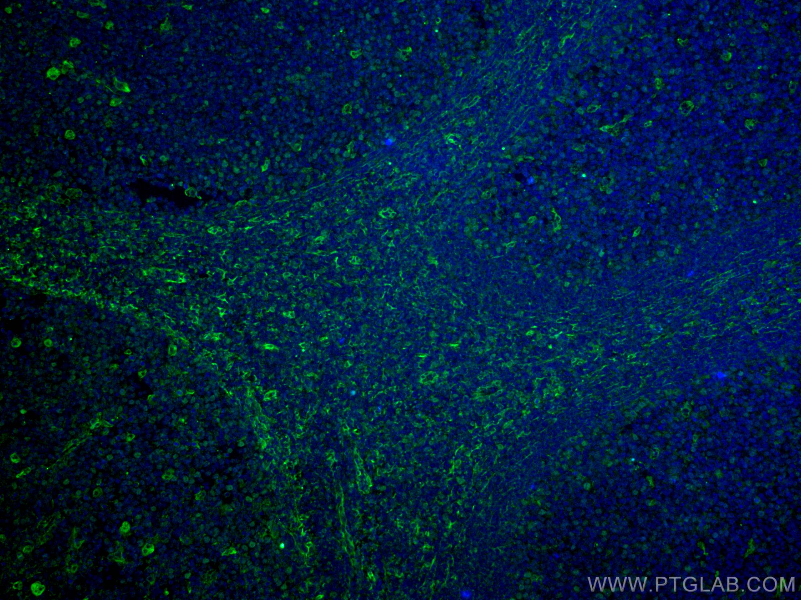 Immunofluorescence (IF) / fluorescent staining of human tonsillitis tissue using CD63 Monoclonal antibody (67605-1-Ig)