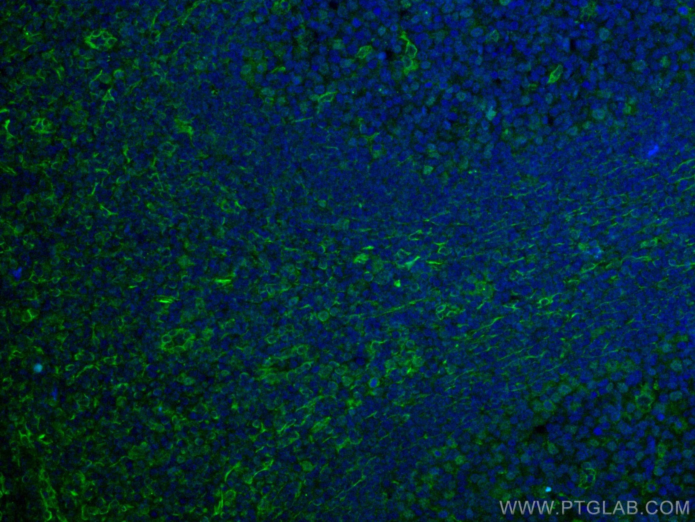 Immunofluorescence (IF) / fluorescent staining of human tonsillitis tissue using CD63 Monoclonal antibody (67605-1-Ig)