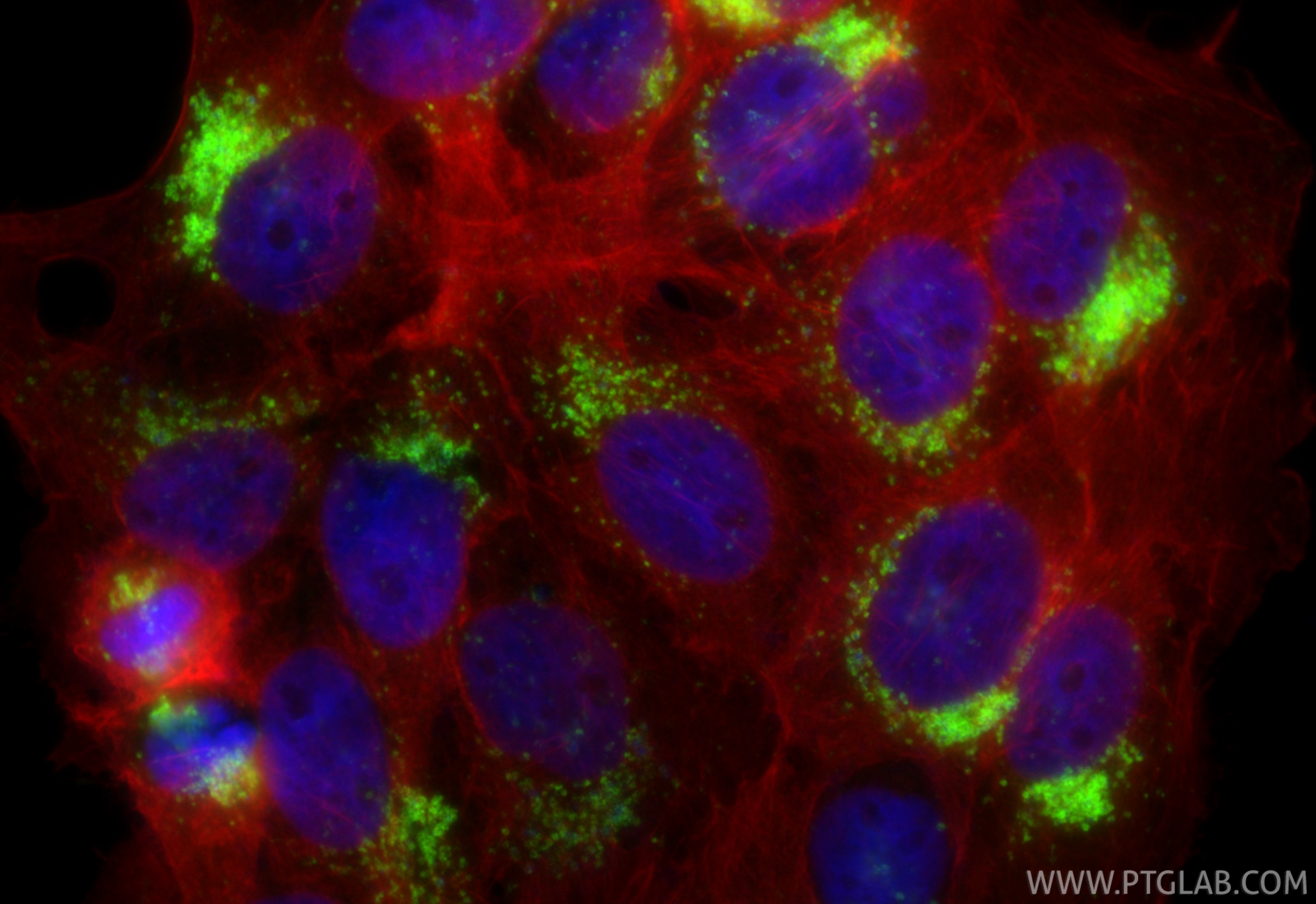 Immunofluorescence (IF) / fluorescent staining of A431 cells using CD63 Recombinant monoclonal antibody (84507-4-RR)
