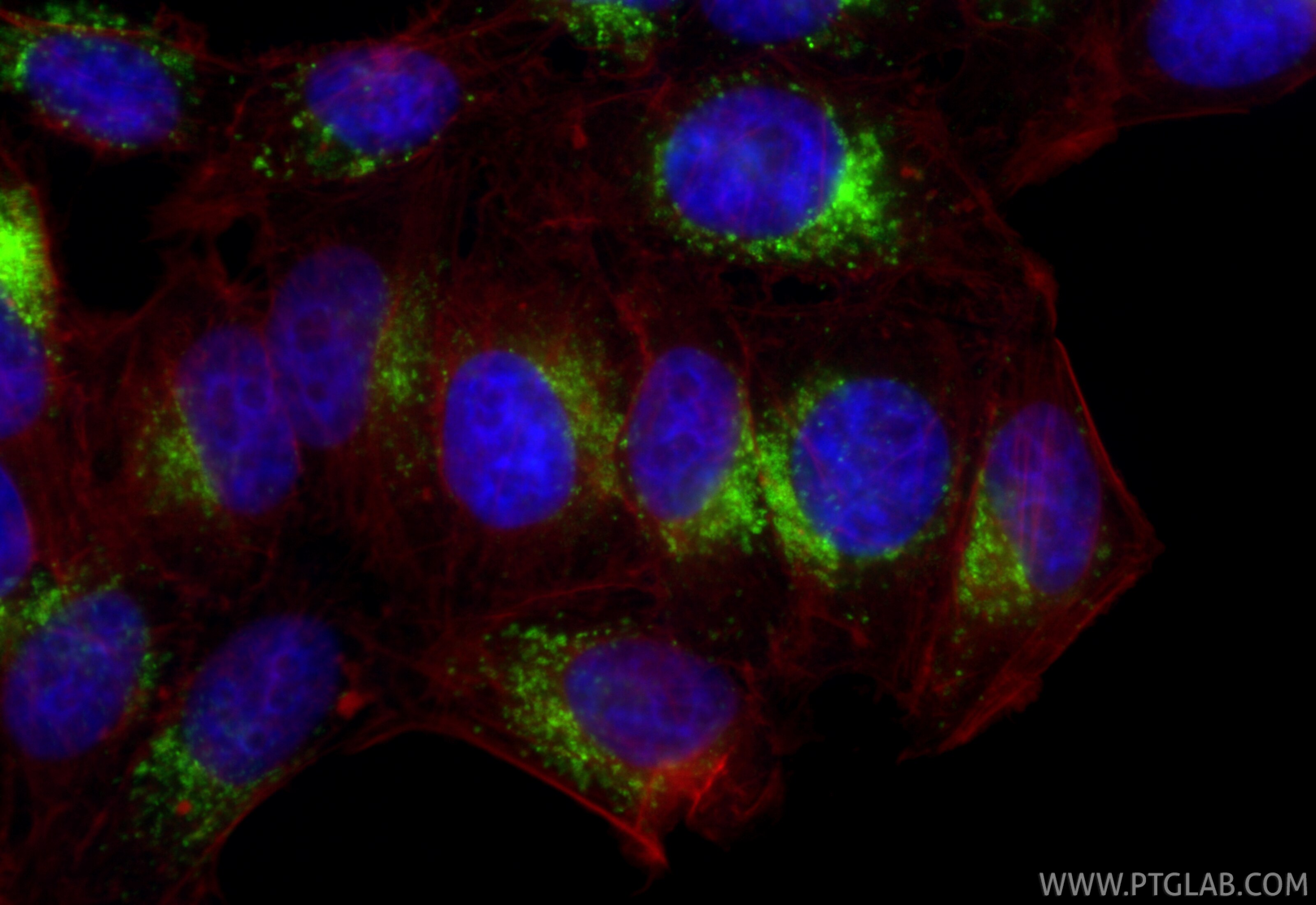 Immunofluorescence (IF) / fluorescent staining of HepG2 cells using CD63 Recombinant monoclonal antibody (84507-4-RR)