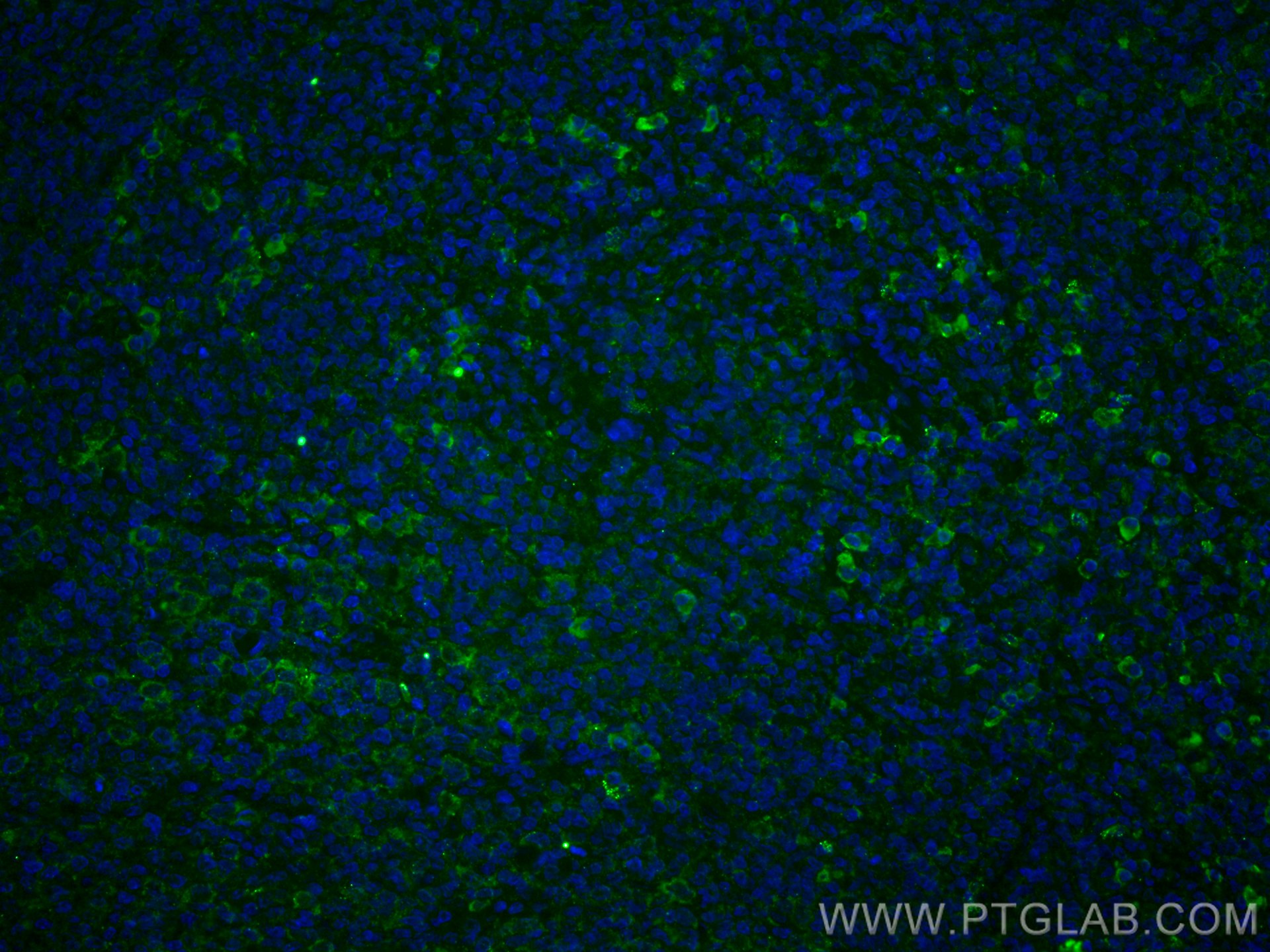 Immunofluorescence (IF) / fluorescent staining of human tonsillitis tissue using CoraLite® Plus 488-conjugated CD63 Monoclonal anti (CL488-67605)