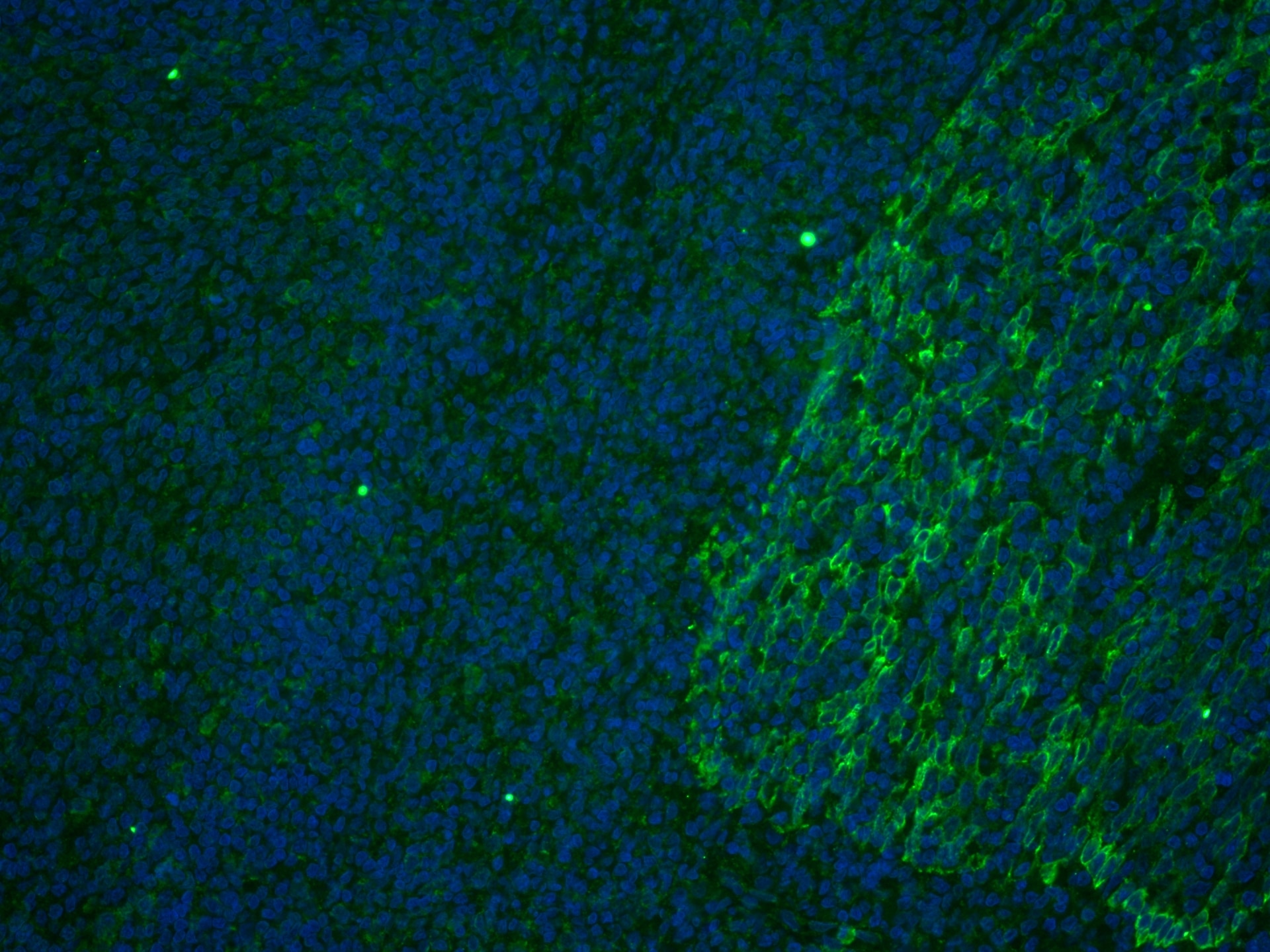 Immunofluorescence (IF) / fluorescent staining of human tonsillitis tissue using CoraLite® Plus 488-conjugated CD63 Monoclonal anti (CL488-67605)