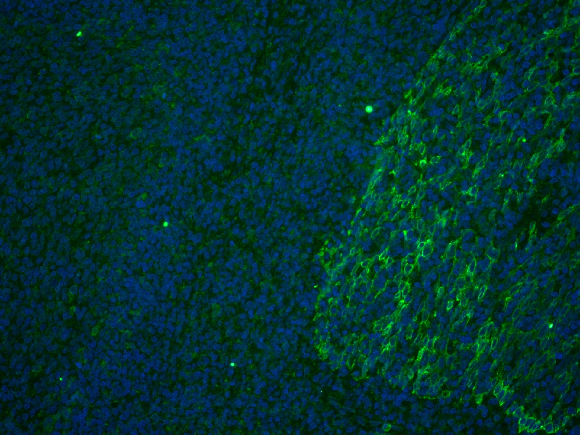 IF Staining of human tonsillitis using CL488-67605