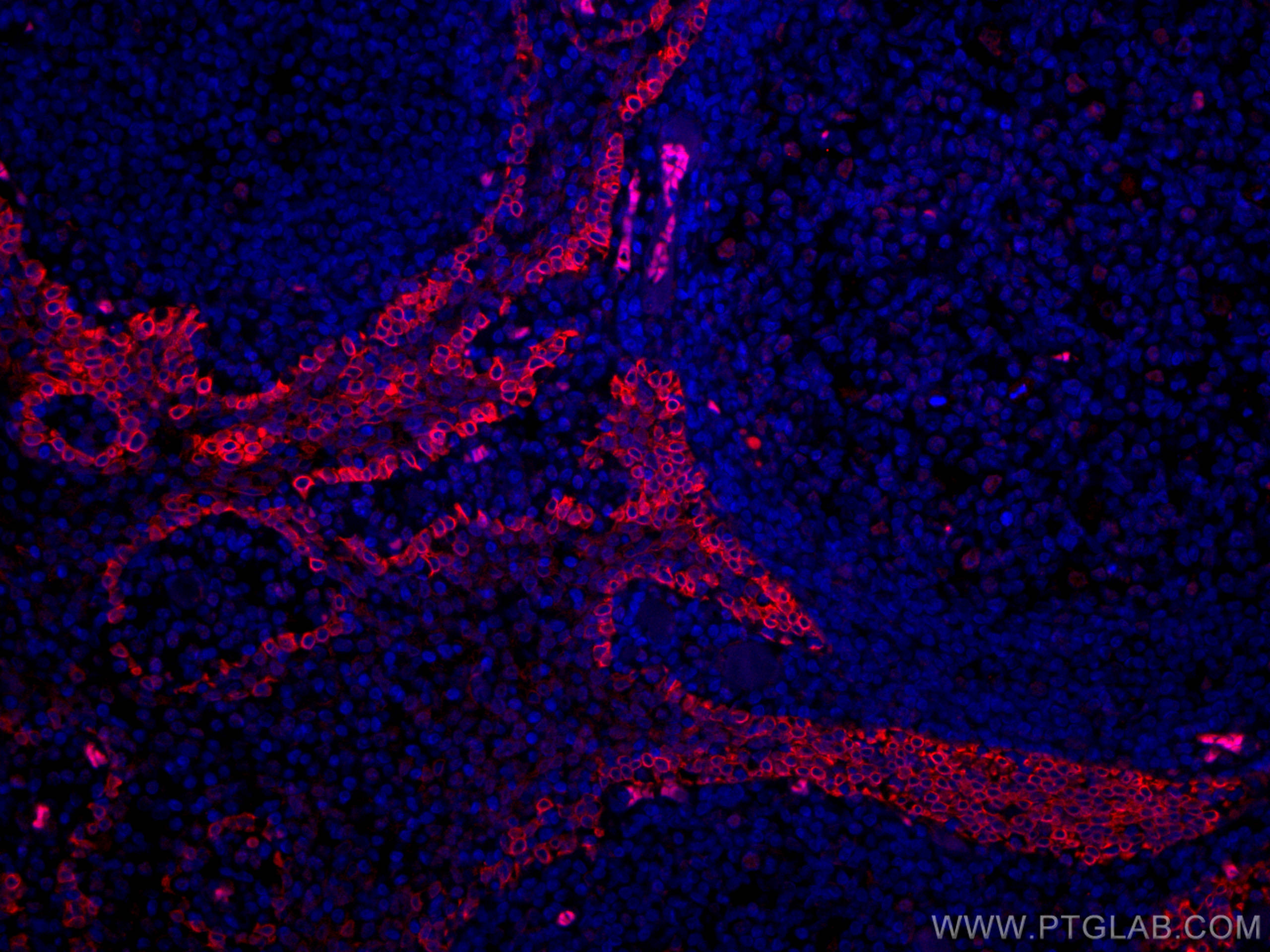 Immunofluorescence (IF) / fluorescent staining of human tonsillitis tissue using CoraLite®594-conjugated CD63 Monoclonal antibody (CL594-67605)