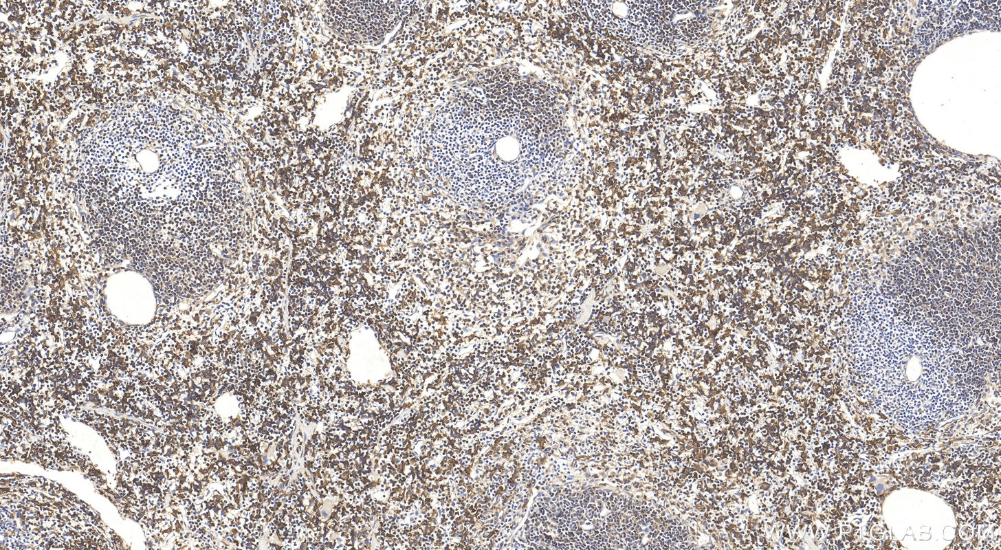 Immunohistochemistry (IHC) staining of mouse spleen tissue using CD64 Polyclonal antibody (32060-1-AP)