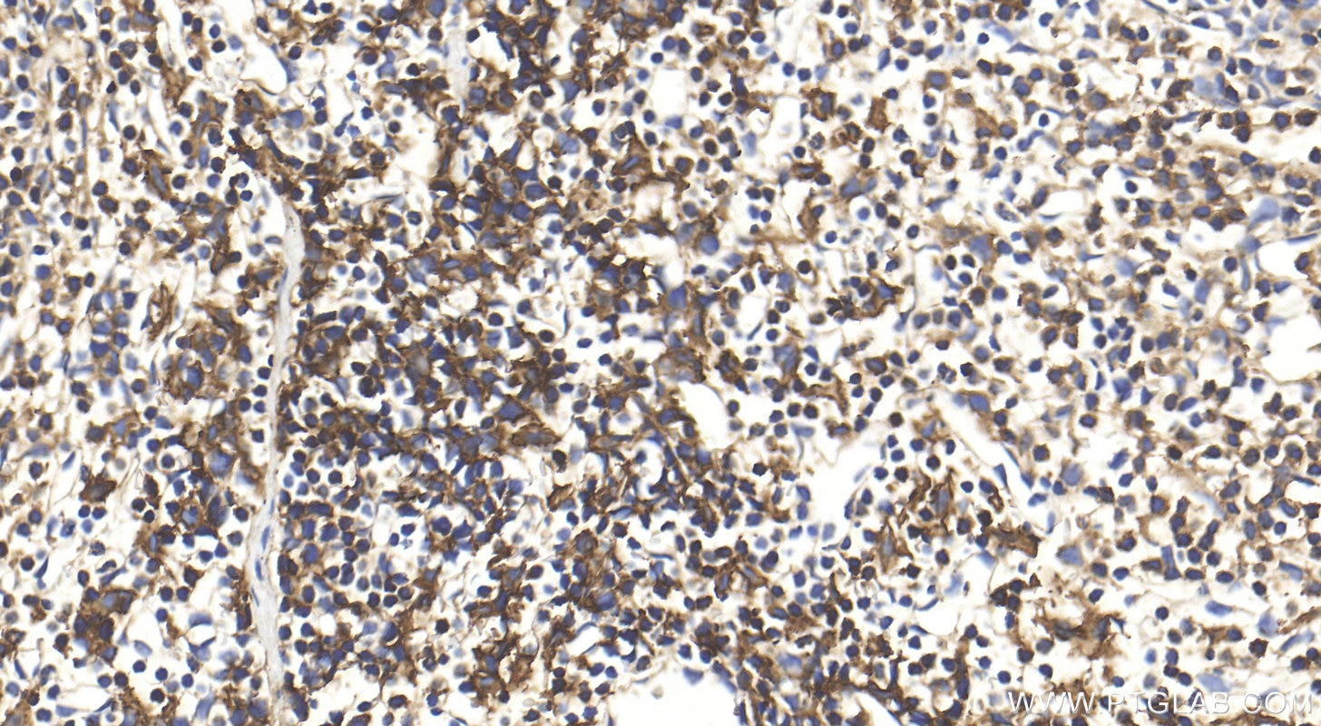 Immunohistochemistry (IHC) staining of mouse spleen tissue using CD64 Polyclonal antibody (32060-1-AP)