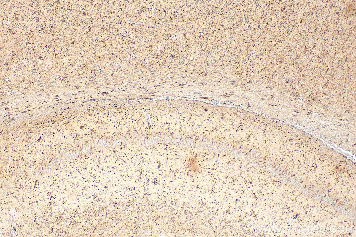 Immunohistochemistry (IHC) staining of mouse brain tissue using CD64 Polyclonal antibody (32060-1-AP)
