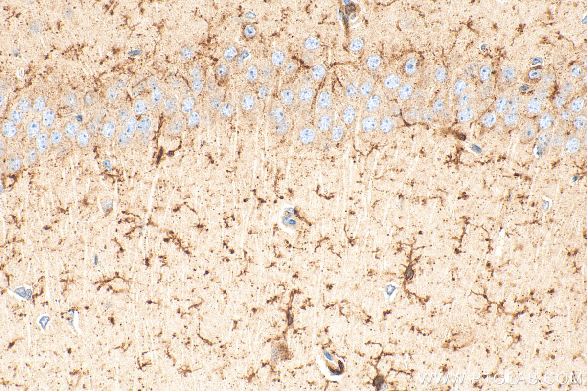 Immunohistochemistry (IHC) staining of mouse brain tissue using CD64 Polyclonal antibody (32060-1-AP)