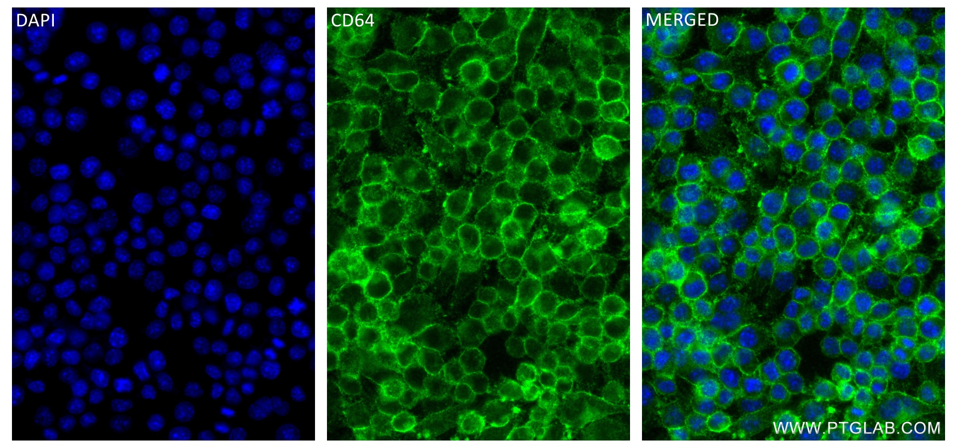 Immunofluorescence (IF) / fluorescent staining of RAW 264.7 cells using CD64 Recombinant antibody (84518-2-RR)
