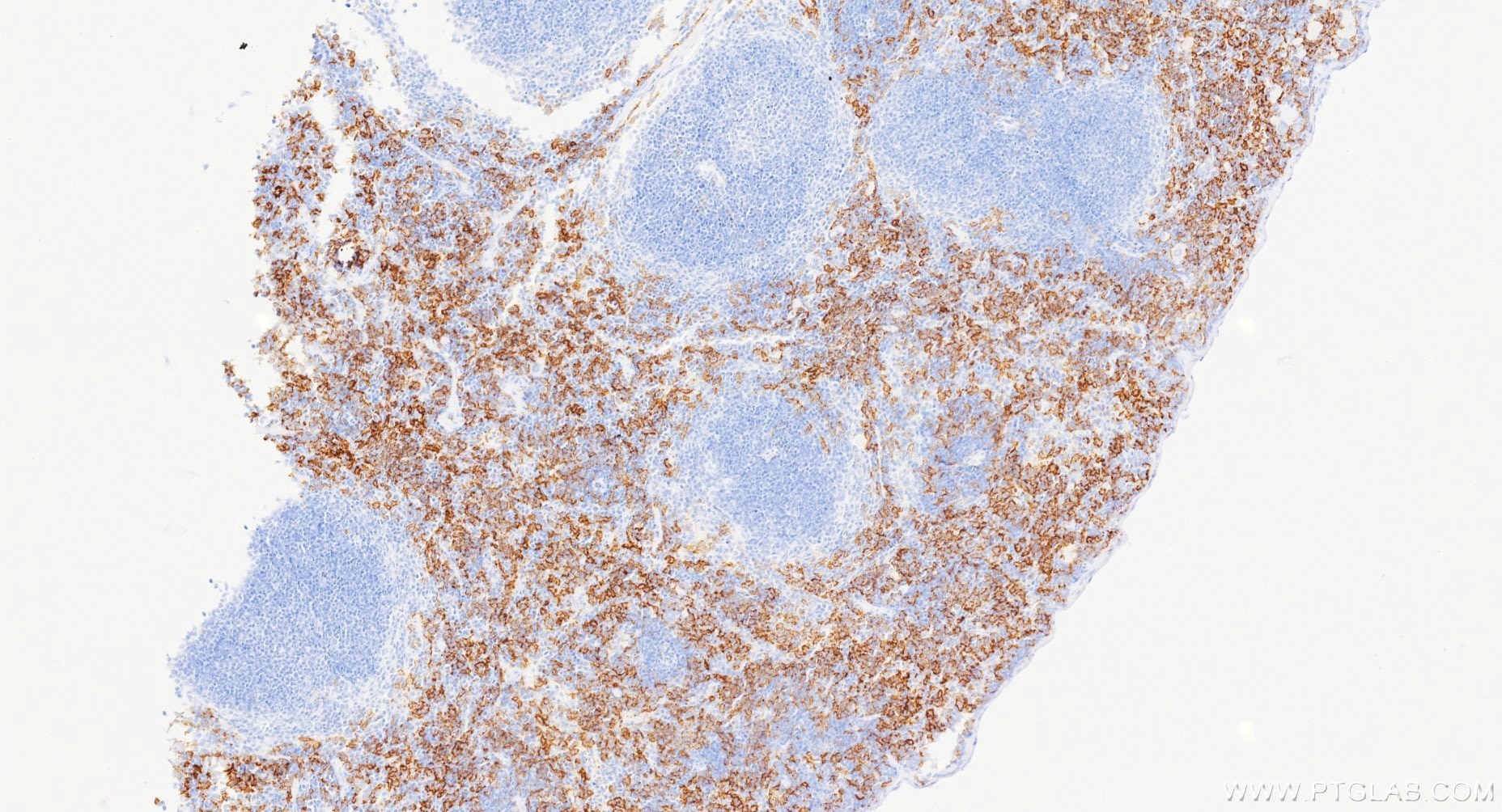 IHC staining of mouse spleen using 84518-2-RR Immunohistochemistry (IHC) staining of mouse spleen tissue using CD64 Recombinant monoclonal antibody (84518-2-RR)