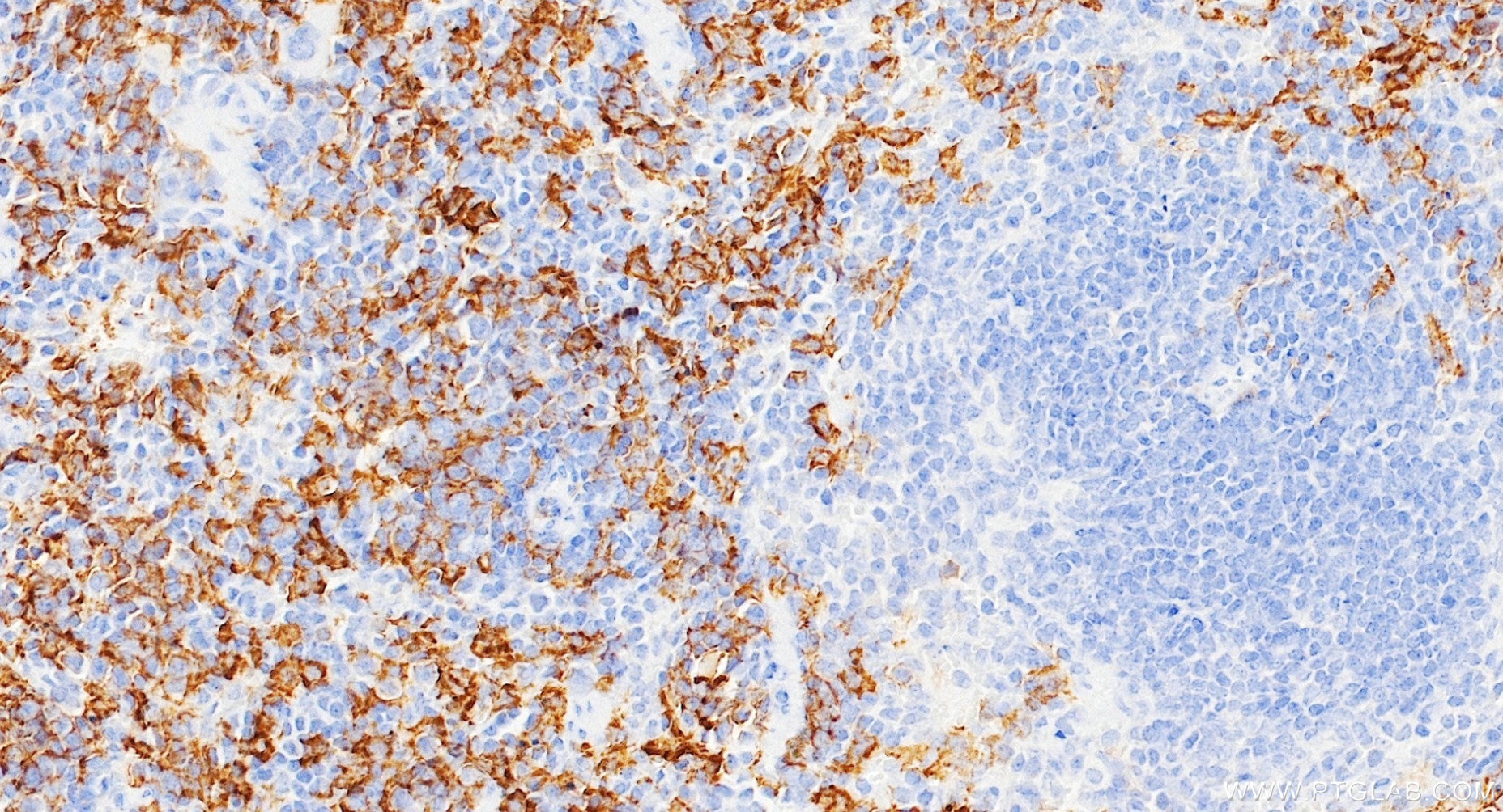 IHC staining of mouse spleen using 84518-2-RR Immunohistochemistry (IHC) staining of mouse spleen tissue using CD64 Recombinant monoclonal antibody (84518-2-RR)