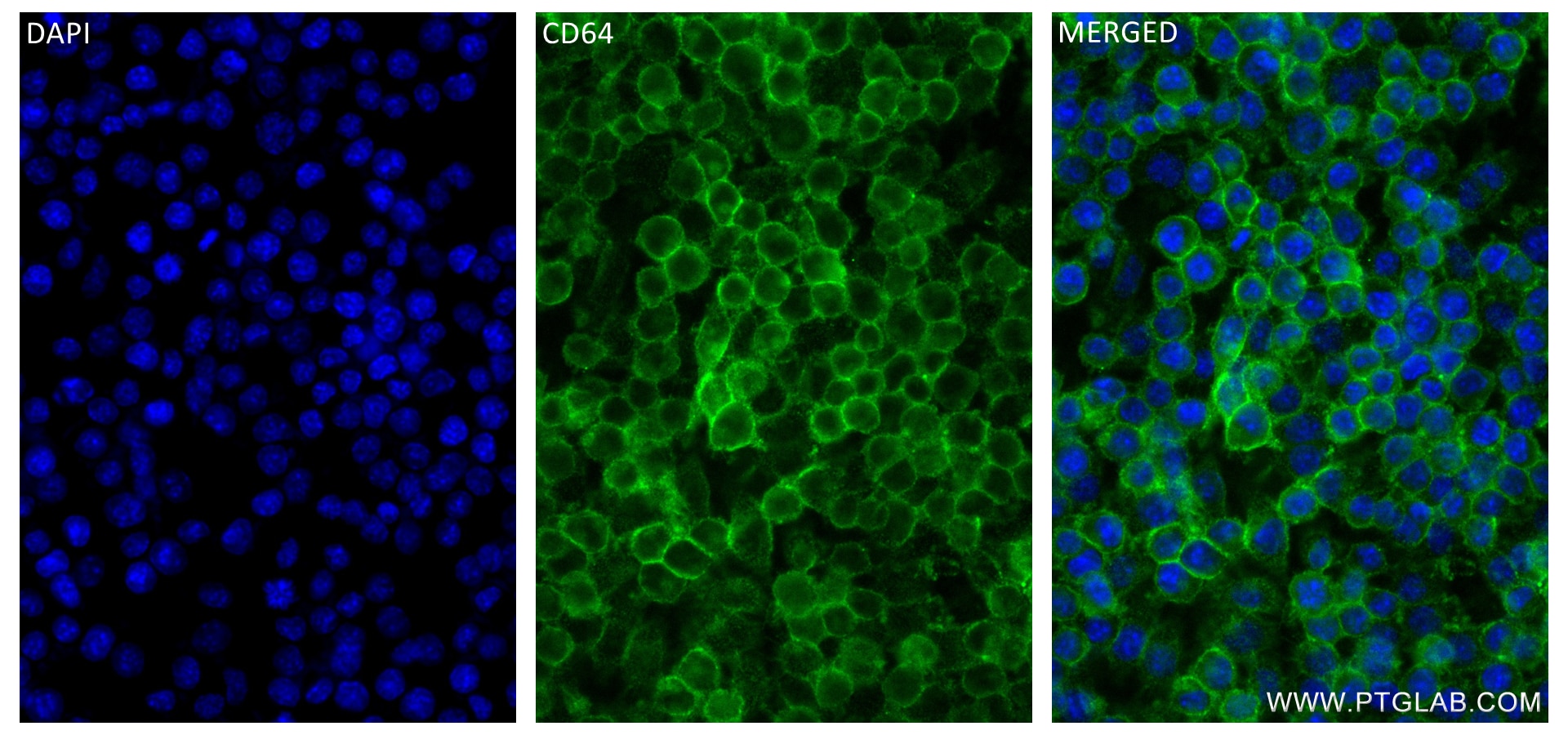 Immunofluorescence (IF) / fluorescent staining of RAW 264.7 cells using CD64 Recombinant antibody (84518-3-RR)