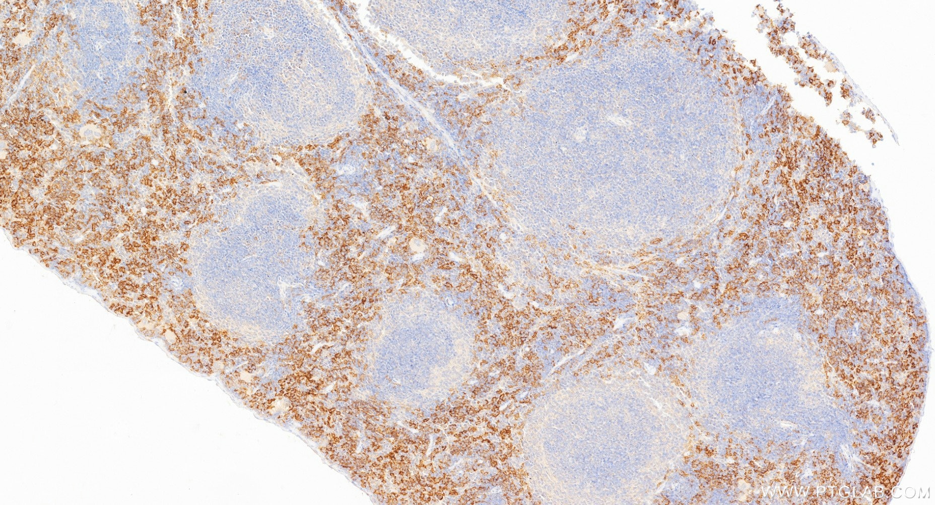 IHC staining of mouse spleen using 84518-3-RR Immunohistochemistry (IHC) staining of mouse spleen tissue using CD64 Recombinant monoclonal antibody (84518-3-RR)