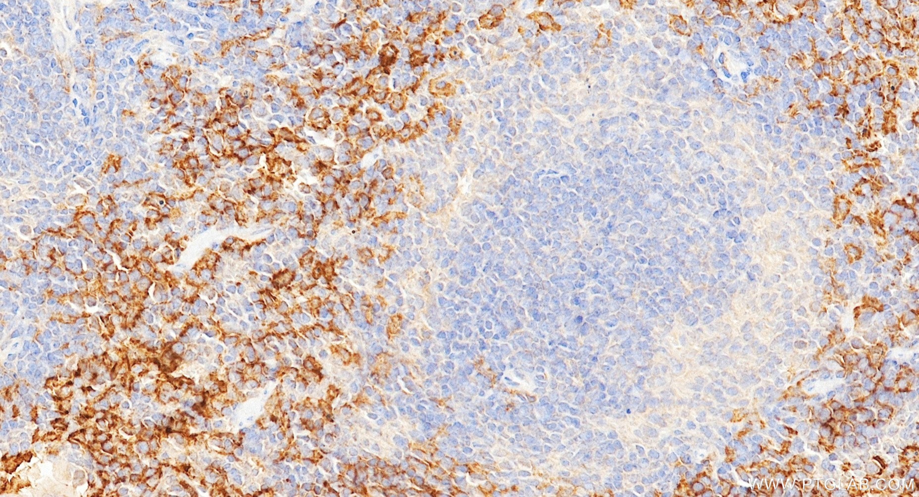 IHC staining of mouse spleen using 84518-3-RR Immunohistochemistry (IHC) staining of mouse spleen tissue using CD64 Recombinant monoclonal antibody (84518-3-RR)
