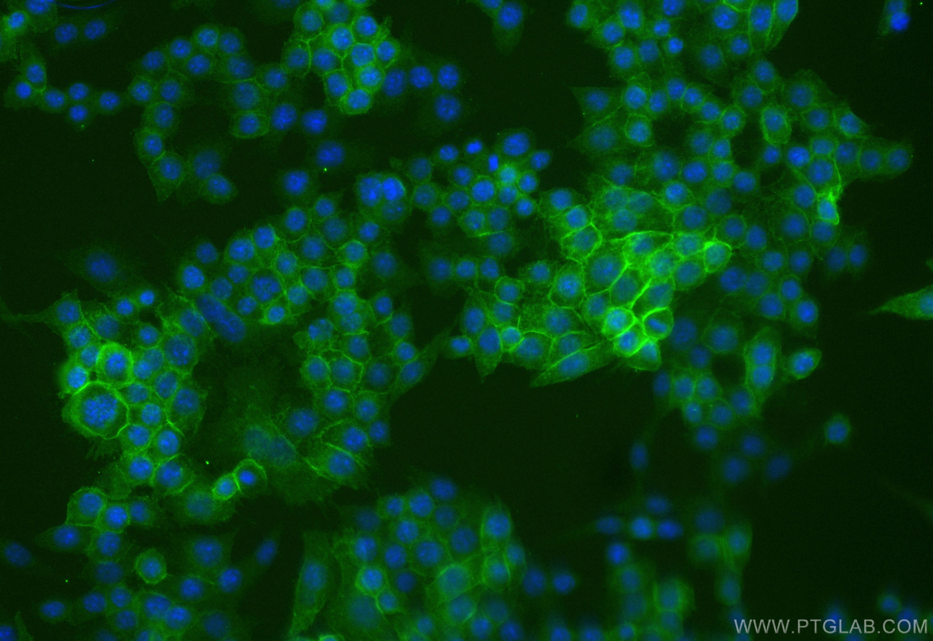 Immunofluorescence (IF) / fluorescent staining of RAW 264.7 cells using CoraLite® Plus 488-conjugated CD64 Recombinant ant (CL488-84518-2)