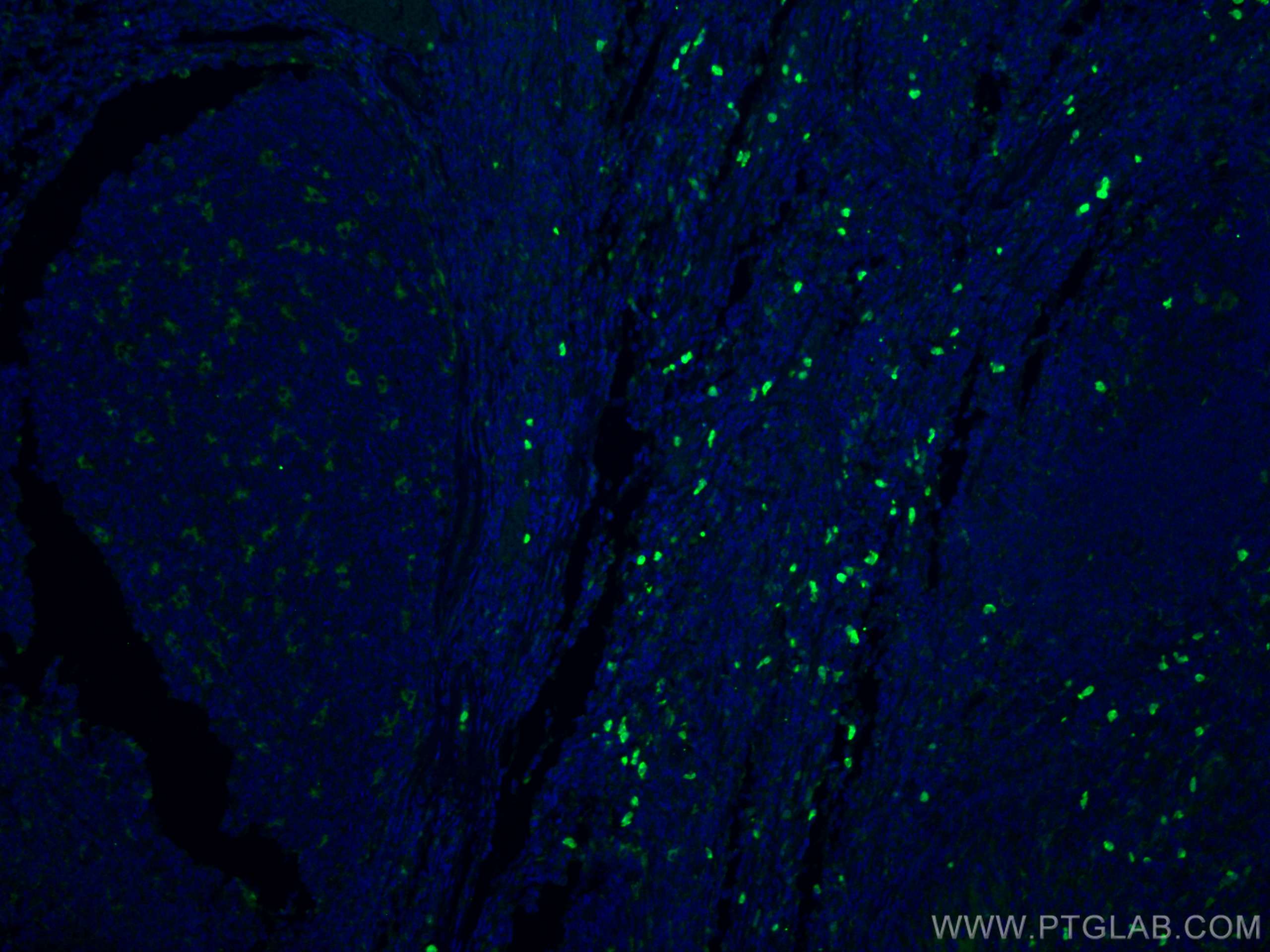 Immunofluorescence (IF) / fluorescent staining of human tonsillitis tissue using CD68 Polyclonal antibody (25747-1-AP)