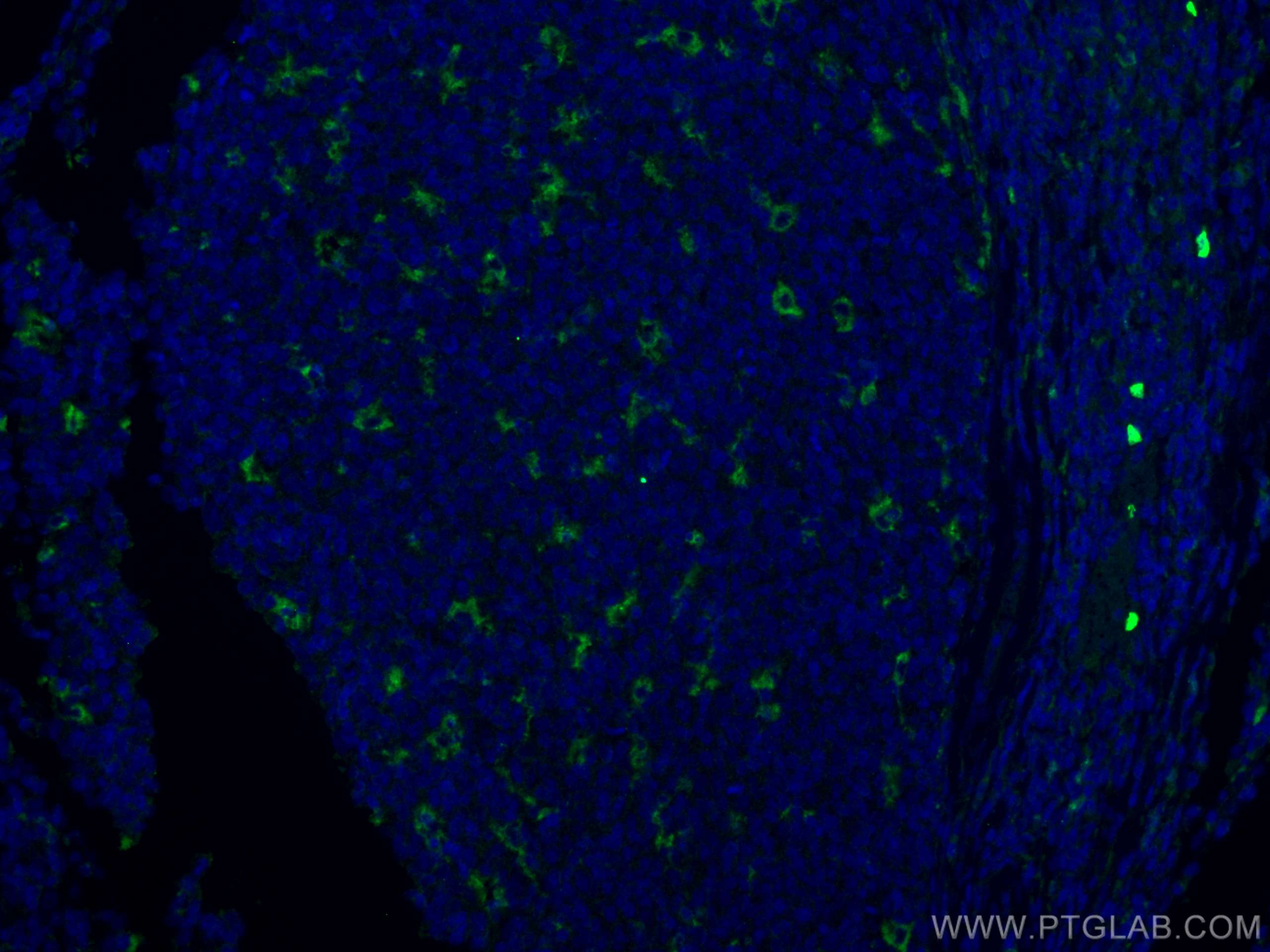 Immunofluorescence (IF) / fluorescent staining of human tonsillitis tissue using CD68 Polyclonal antibody (25747-1-AP)