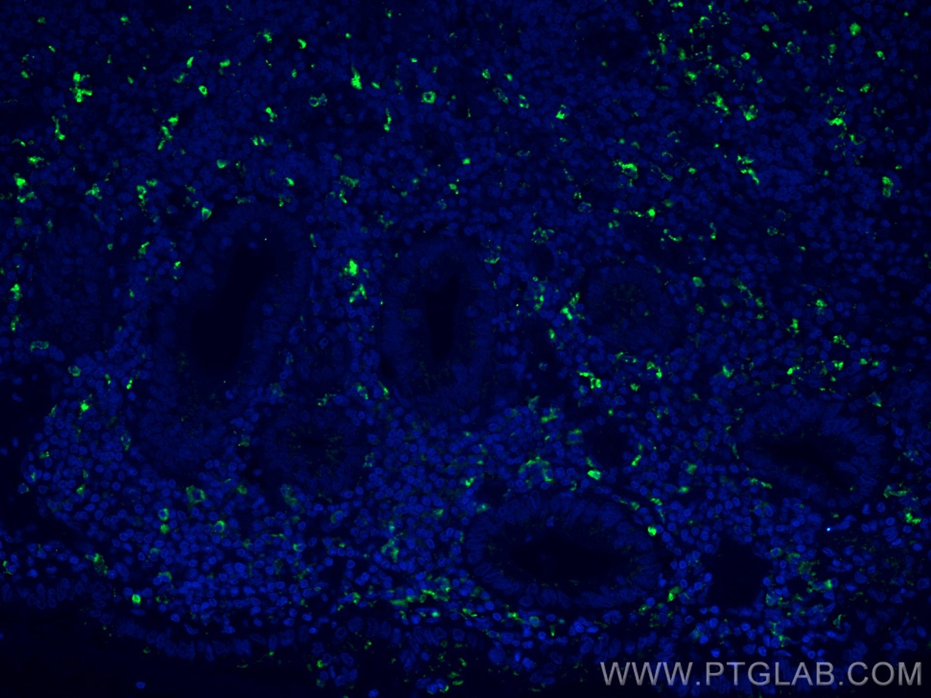 Immunofluorescence (IF) / fluorescent staining of human appendicitis tissue using CD68 Polyclonal antibody (25747-1-AP)