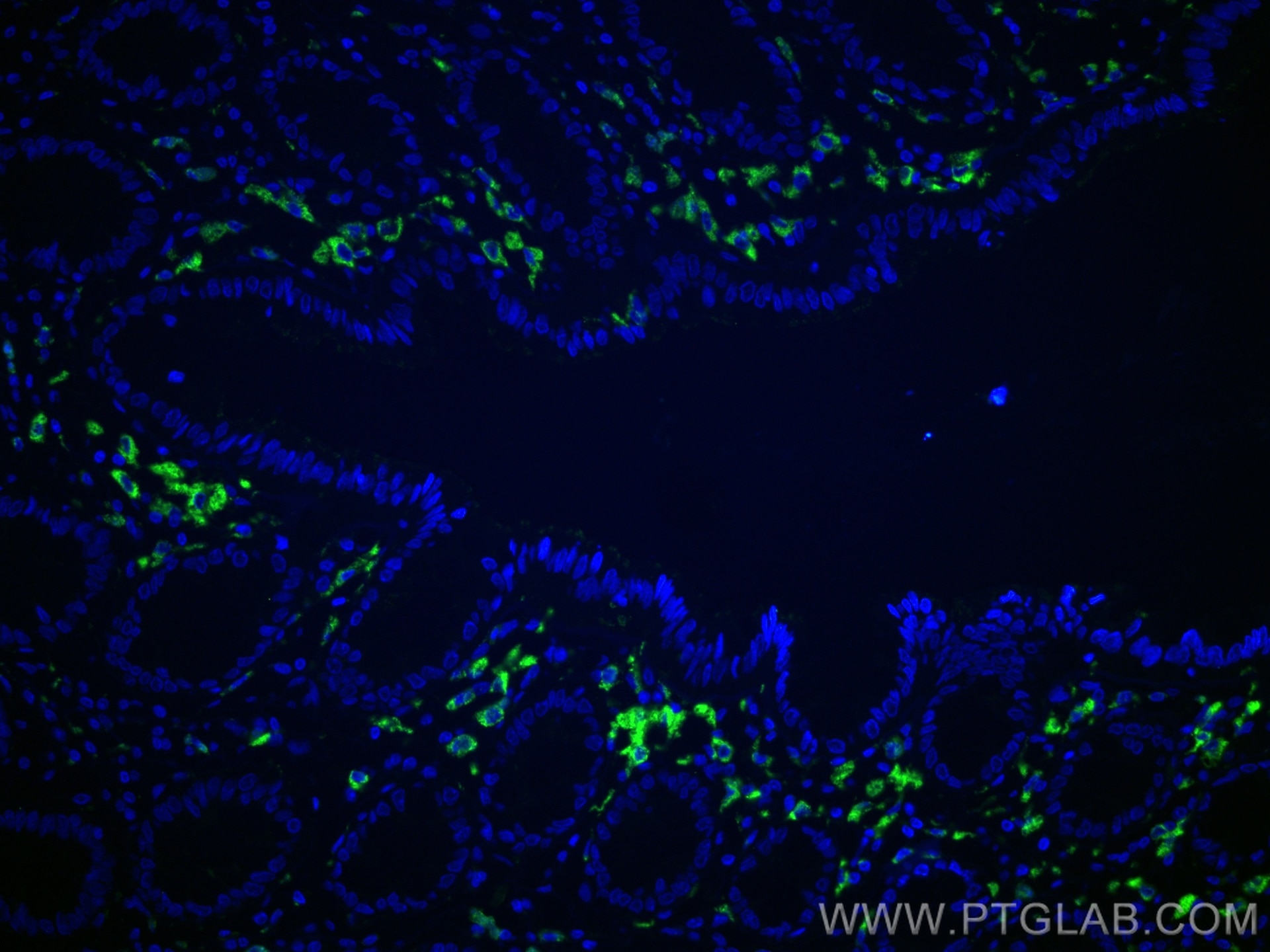 Immunofluorescence (IF) / fluorescent staining of human colon tissue using CD68 Polyclonal antibody (25747-1-AP)