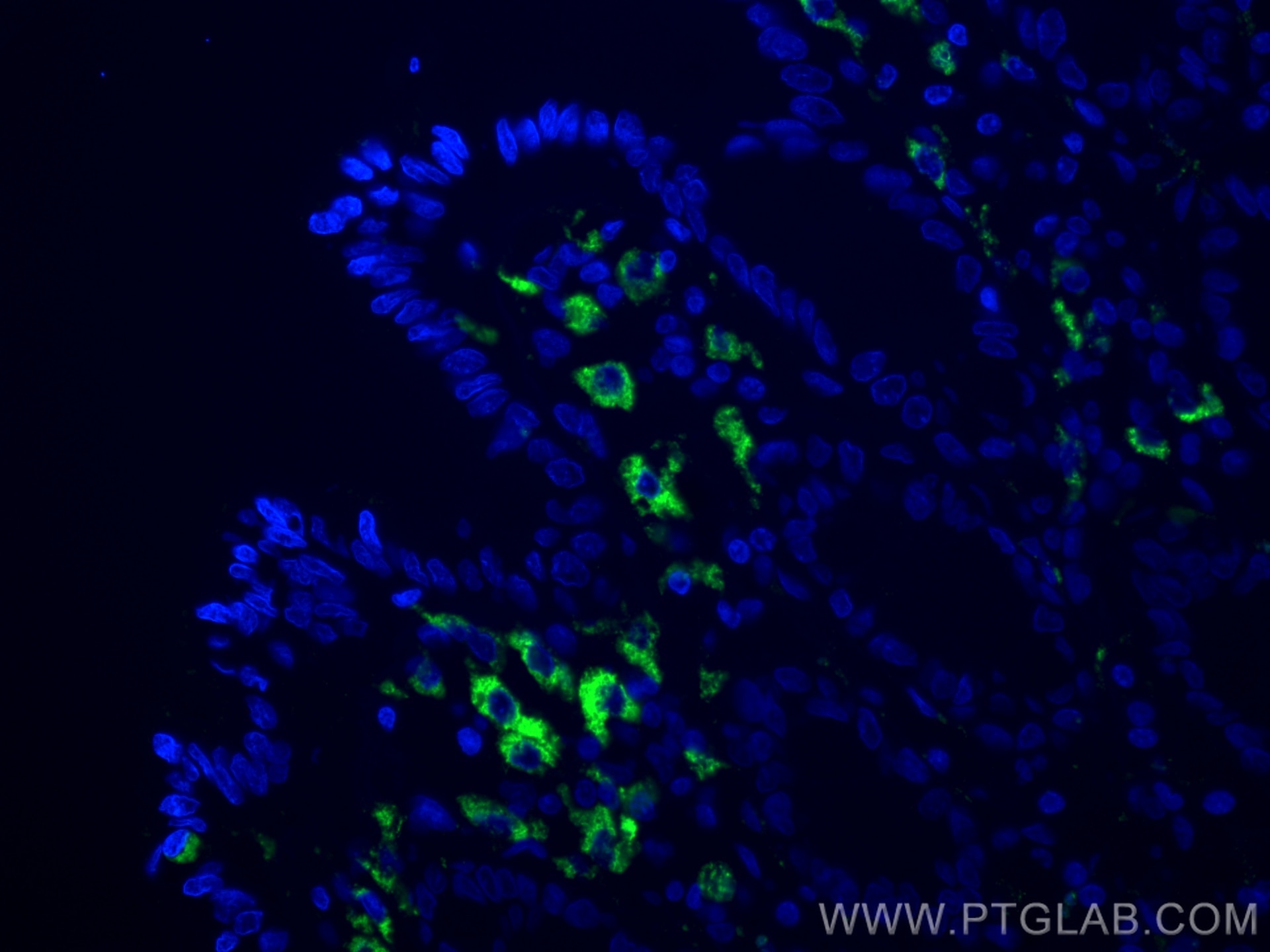 Immunofluorescence (IF) / fluorescent staining of human colon tissue using CD68 Polyclonal antibody (25747-1-AP)